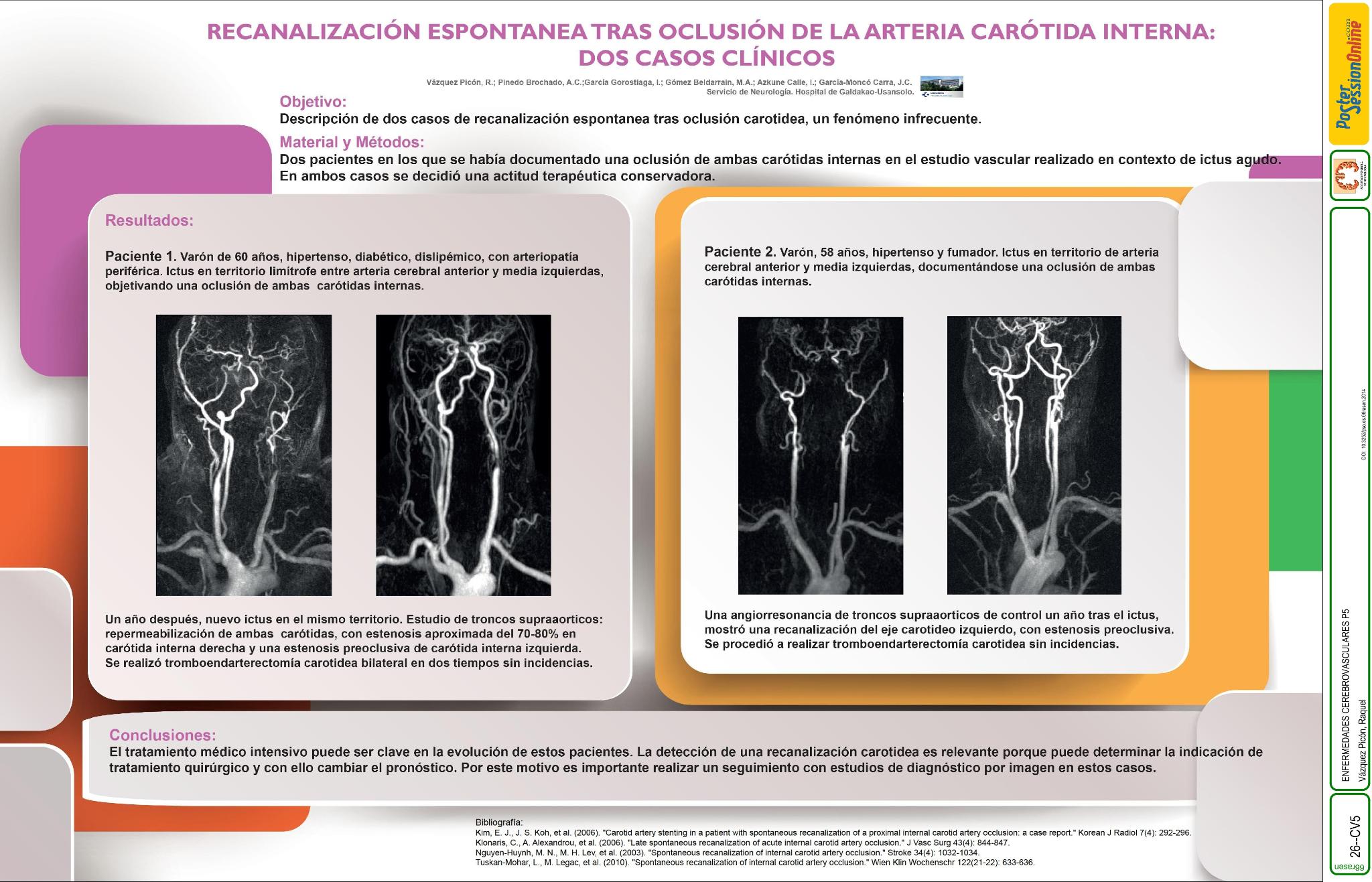 Descripción de tres casos de recanalización espontánea tras oclusión carotidea