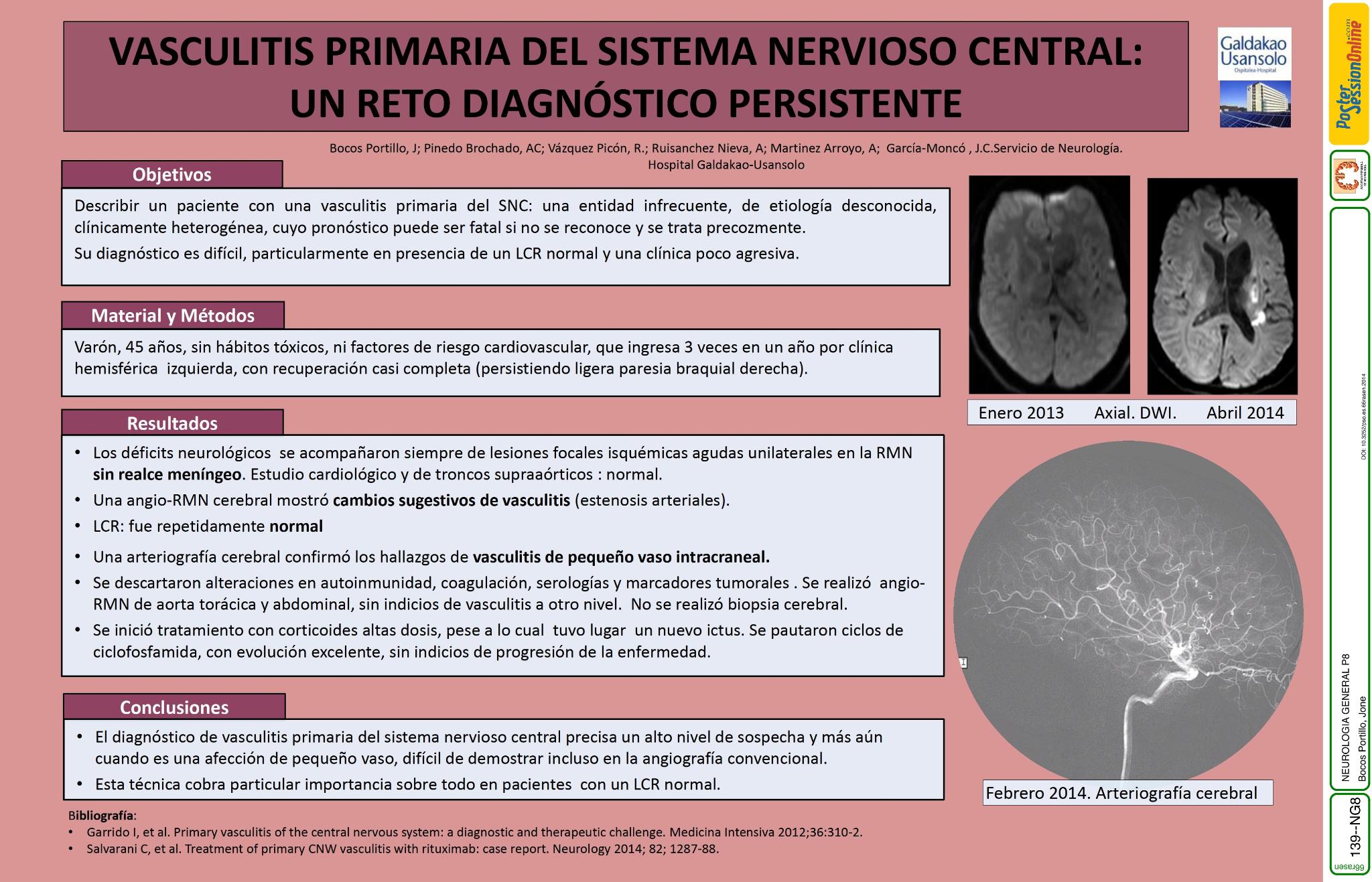 Vasculitis primaria del sistema nervioso central: un reto diagnóstico persistente