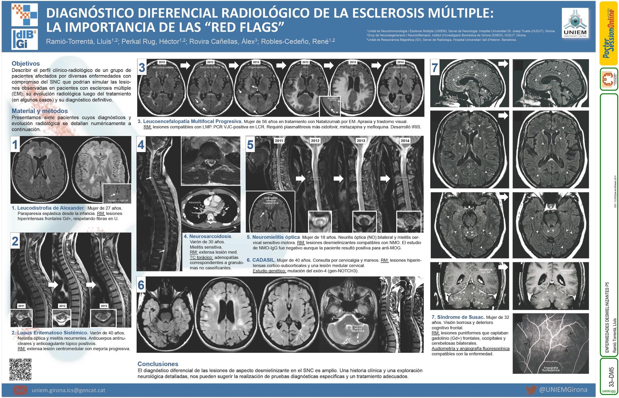 Diagnóstico diferencial radiológico de esclerosis múltiple: la importancia de las “red flags”