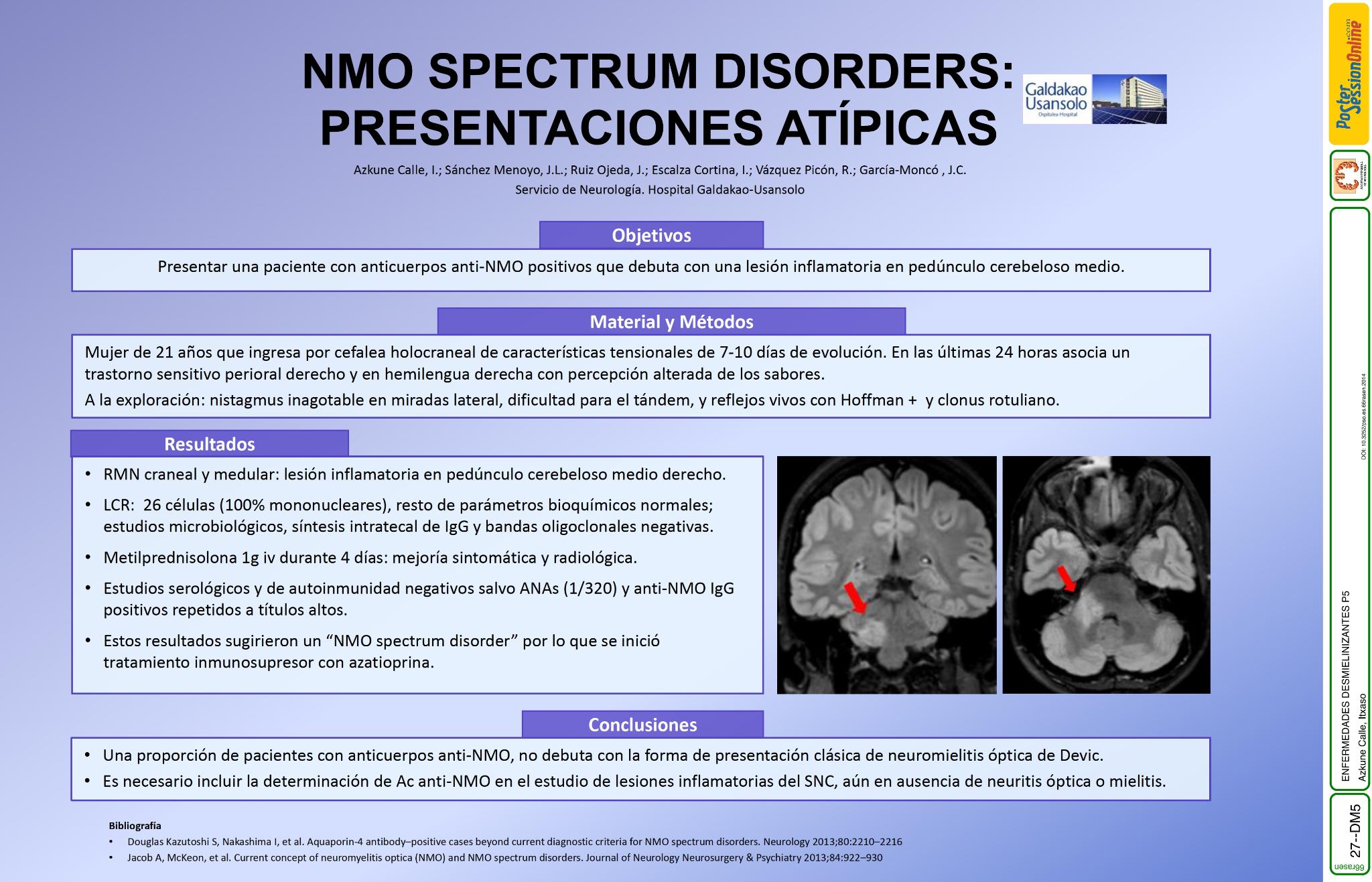 NMO Spectrum Disorders: presentaciones atípicas