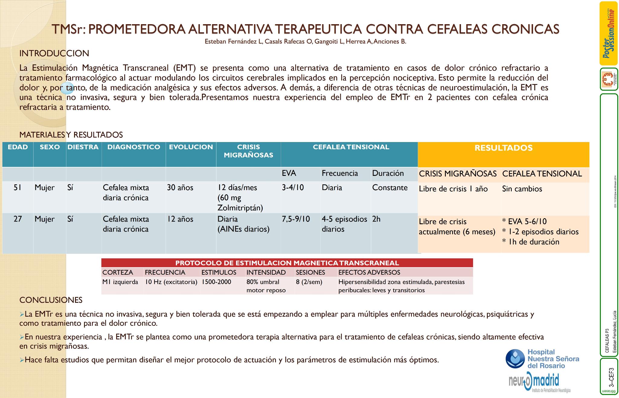 TMSr: prometedora alternativa terapéutica contra cefaleas cronicas