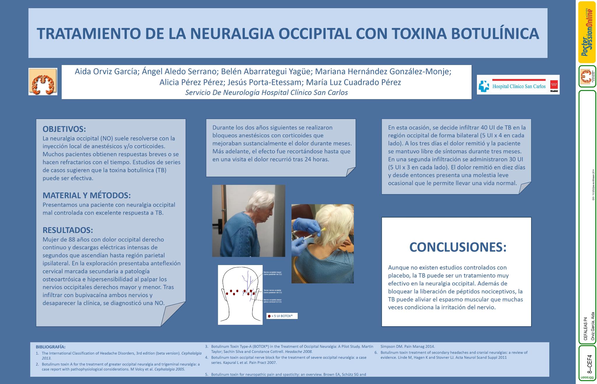 Tratamiento de la neuralgia occipital con toxina botulínica