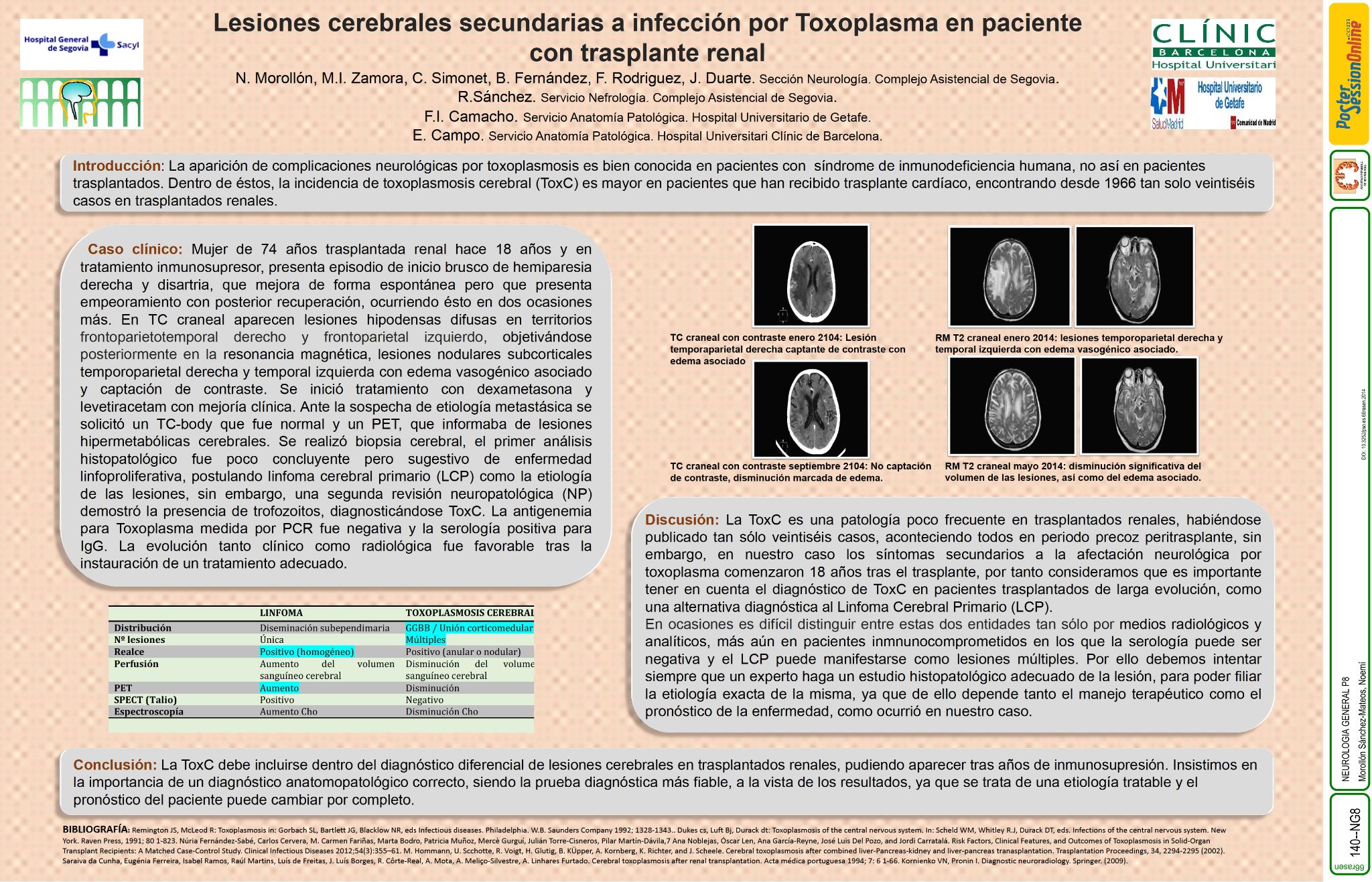 Toxoplasmosis cerebral en paciente con trasplante renal