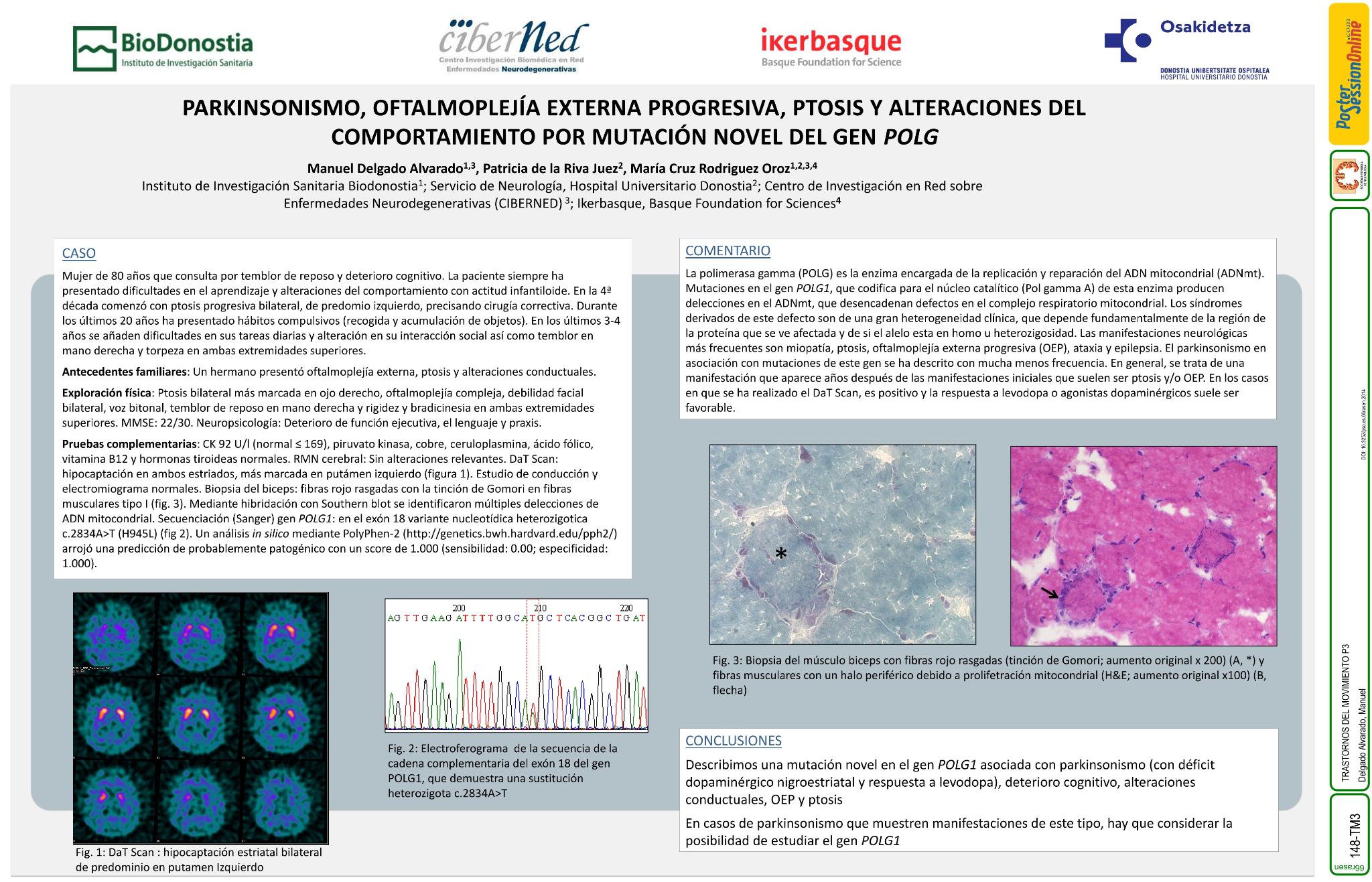 Parkinsonismo, oftalmoplejía externa progresiva, ptosis y alteraciones del comportamiento por mutación novel del gen POLG