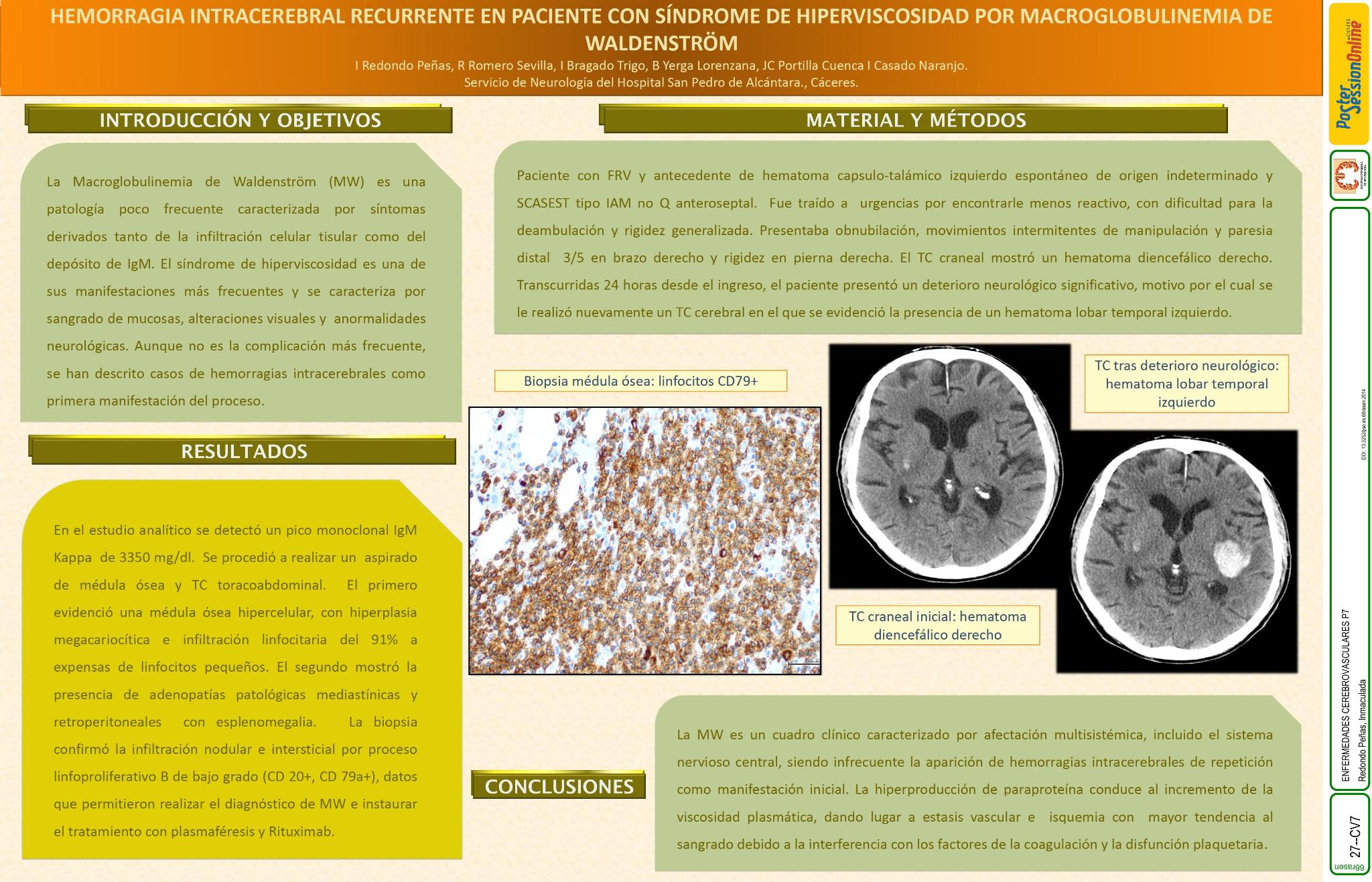 Hemorragia intracerebral recurrente en paciente con síndrome de hiperviscosidad por Macroglobulinemia de Waldeström