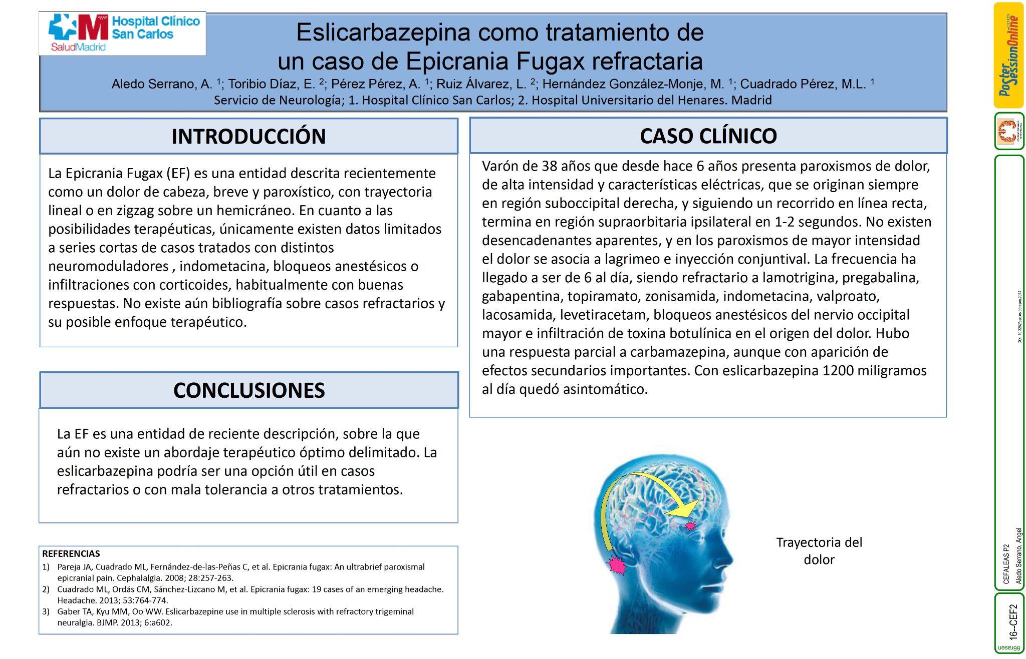 Eslicarbazepina como trataminto de un caso de Epicrania Fugax refractaria