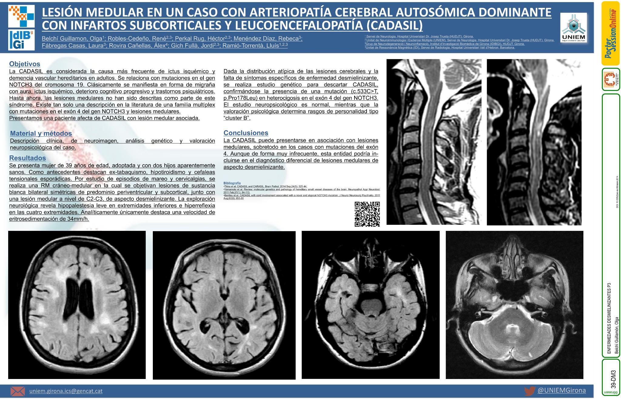 Lesiones medulares en un caso con arteriopatía cerebral autosómica dominante con infartos subcorticales y leucoencefalopatía (CADASIL)