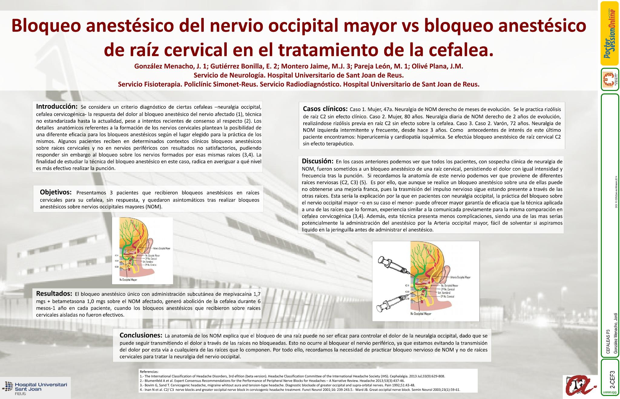 Bloqueo anestésico de nervio occipital mayor vs bloqueo anestésico de raíz cervical en el tratamiento de la cefalea