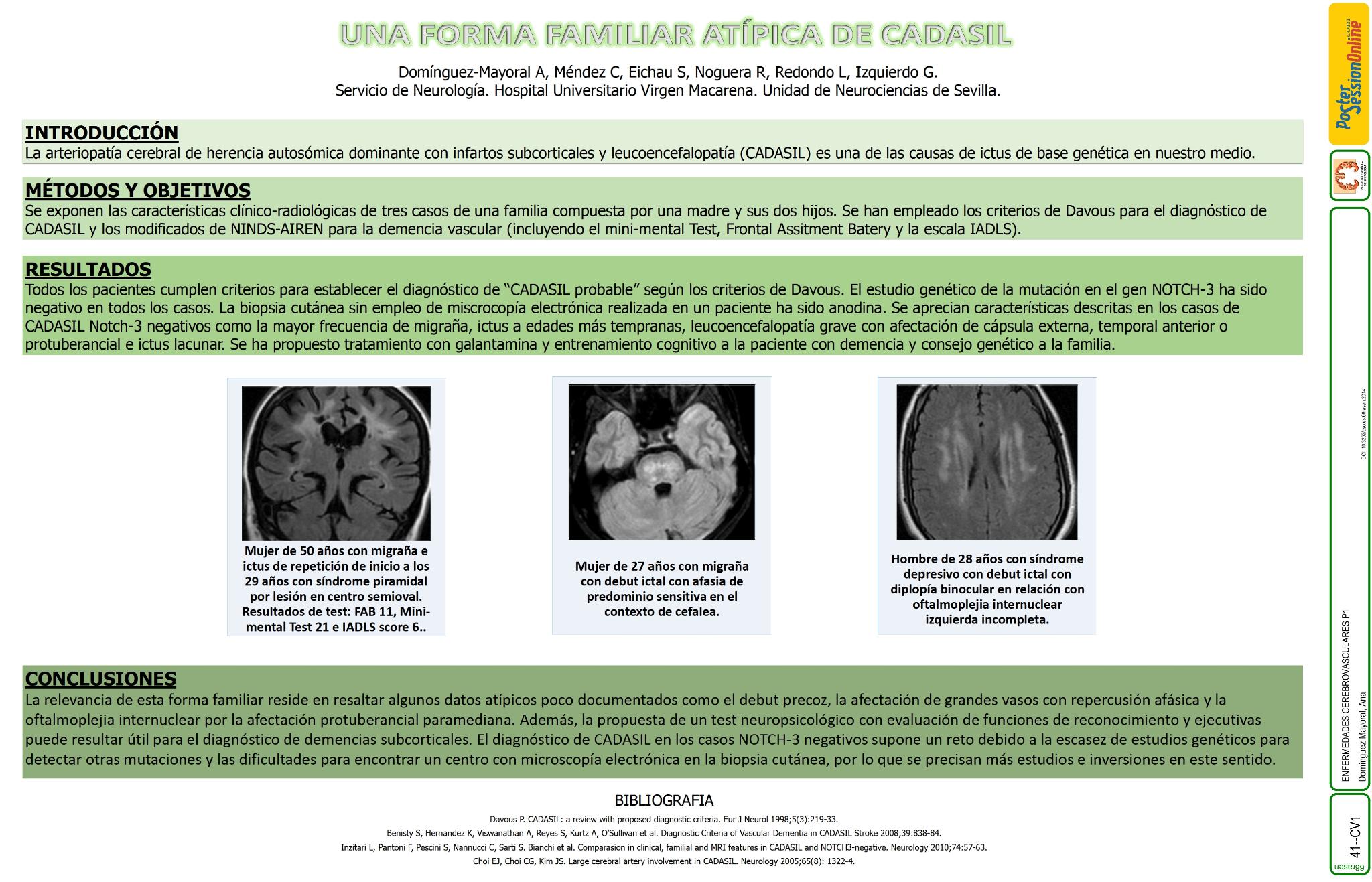Una forma familiar atípica de CADASIL