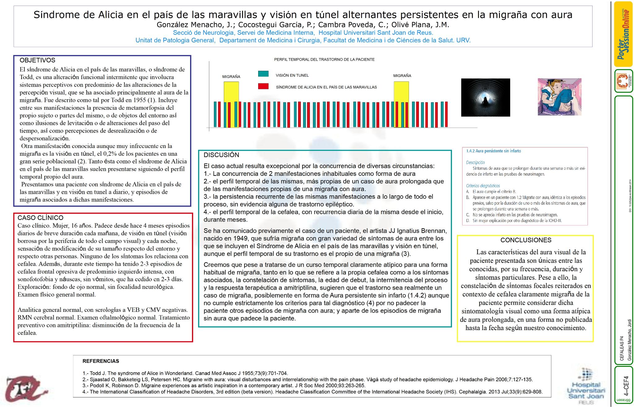 Síndrome de Alicia en el país de las maravillas y visión en tunel alternantes persistentes en la migraña con aura