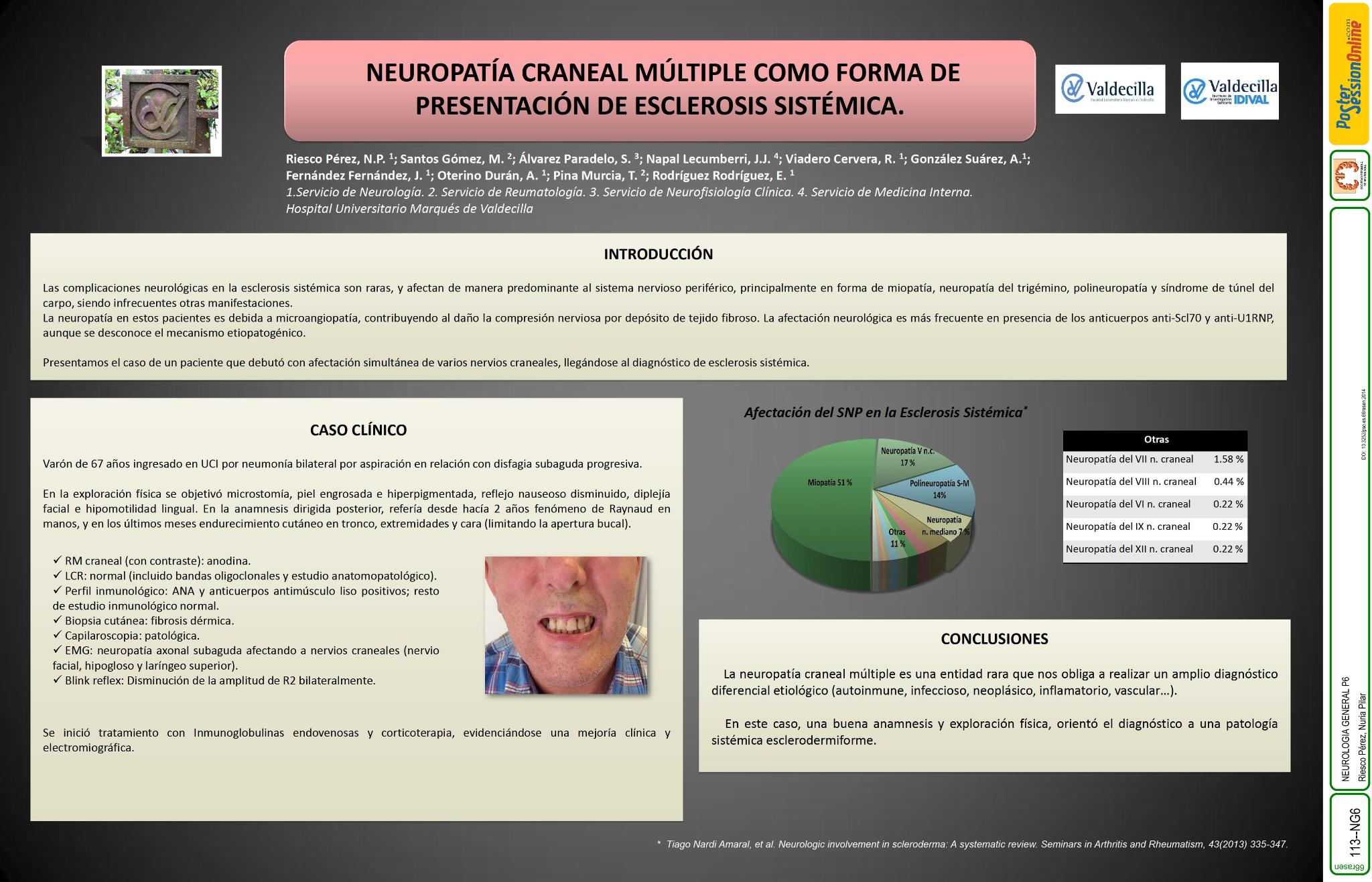 Neuropatía craneal múltiple como forma de presentación de esclerosis sistémica