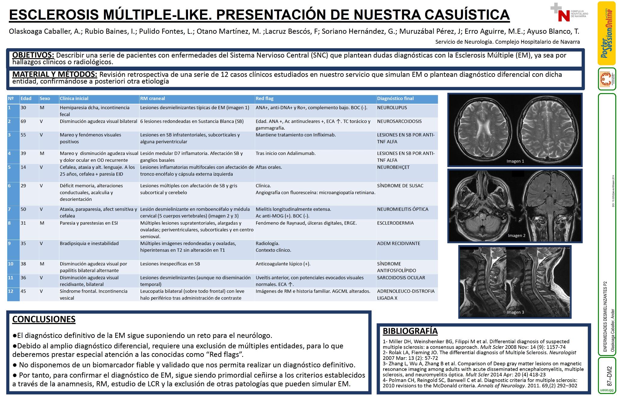 Esclerosis Múltiple-Like. Presentación de nuestra casuística