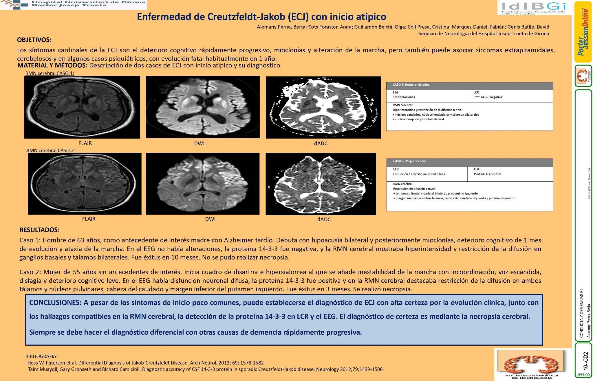Enfermedad de Creutzfeldt-Jakob (ECJ) con inicio atípico