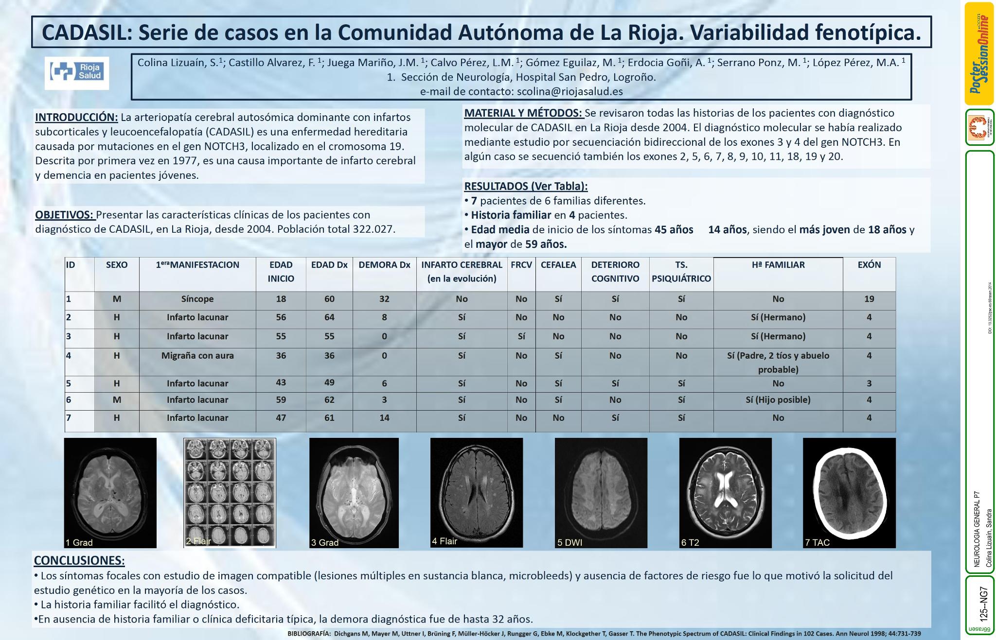 Serie de casos con diagnóstico CADASIL en la Comunidad Autónoma de La Rioja, variabilidad fenotípica