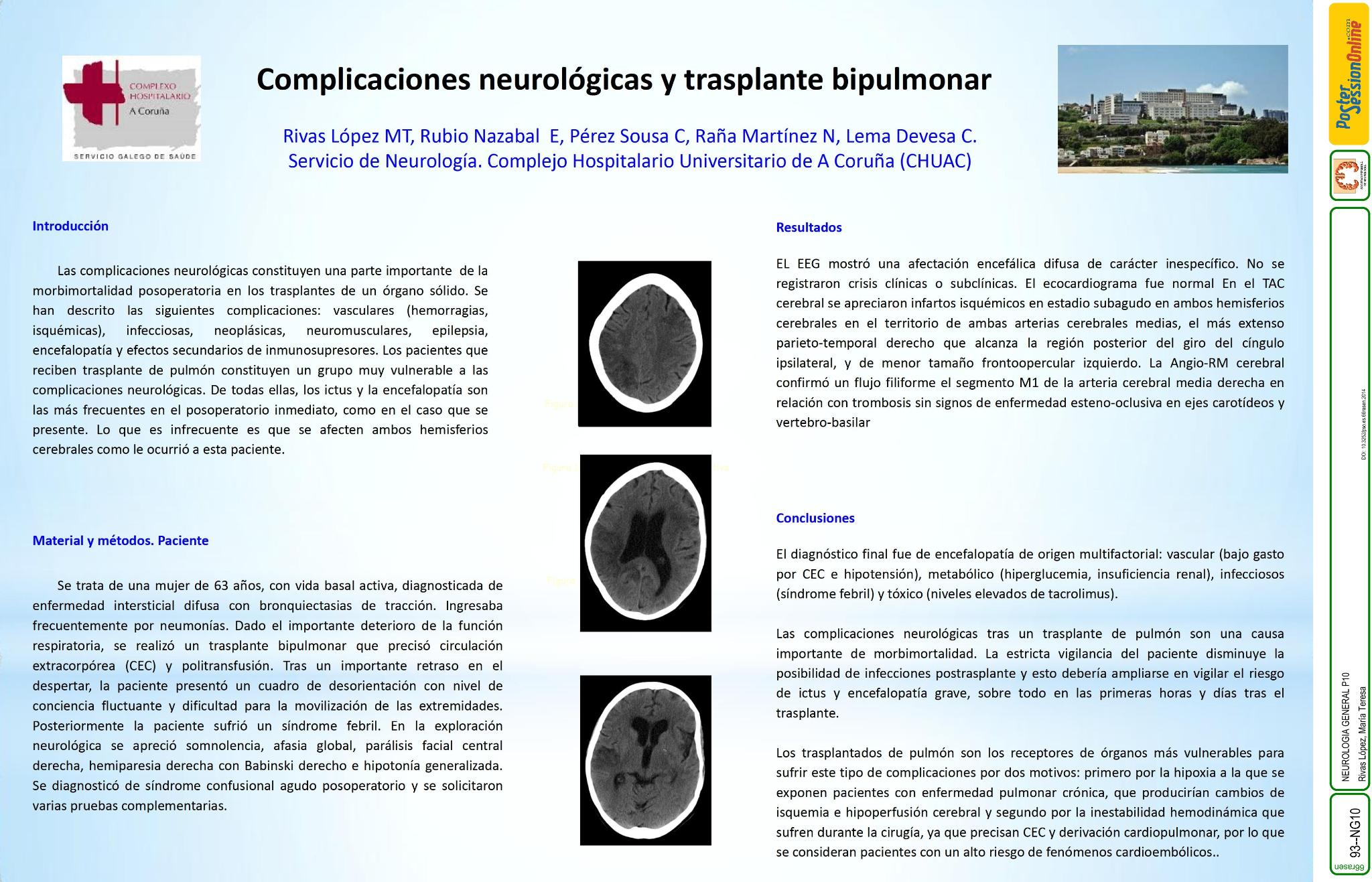 Complicaciones neurológicas y transplante bipulmonar