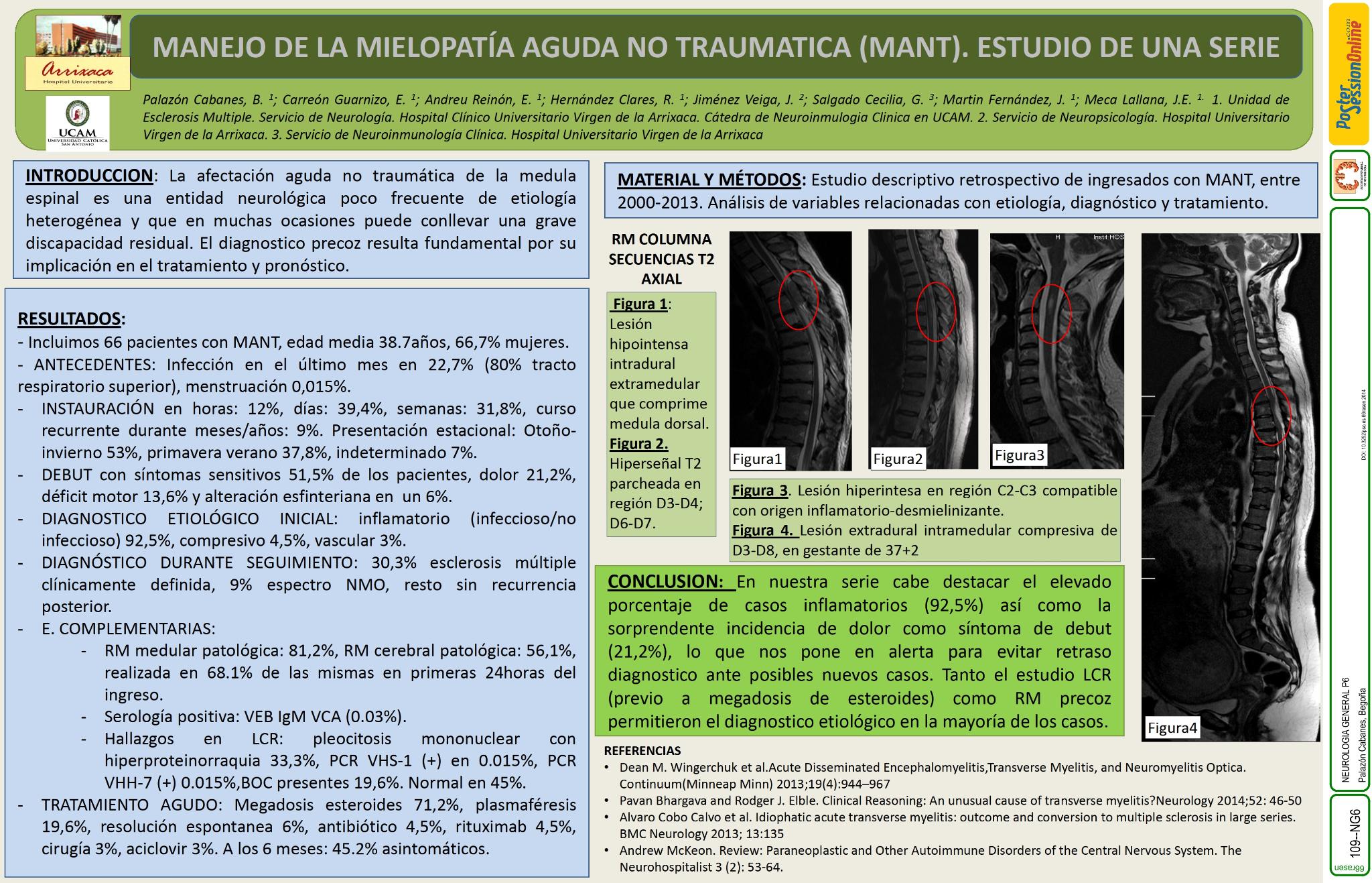 Manejo de la mielopatía aguda no traumatica (MANT). Estudio de una serie