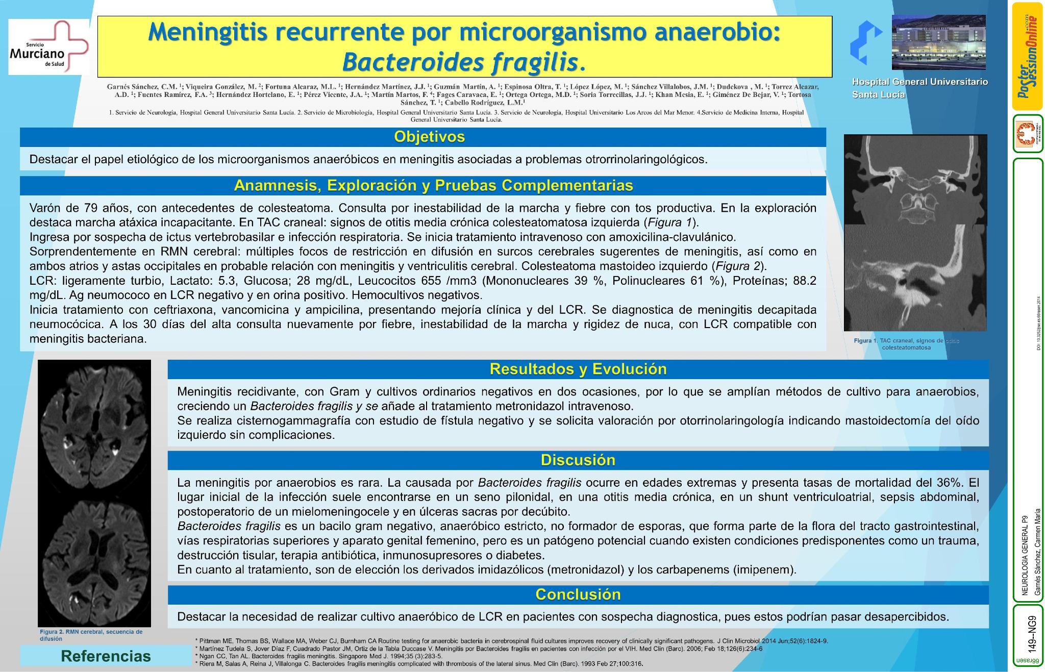 Meningitis recurrente por anaerobios: Bacteroides Fragilis