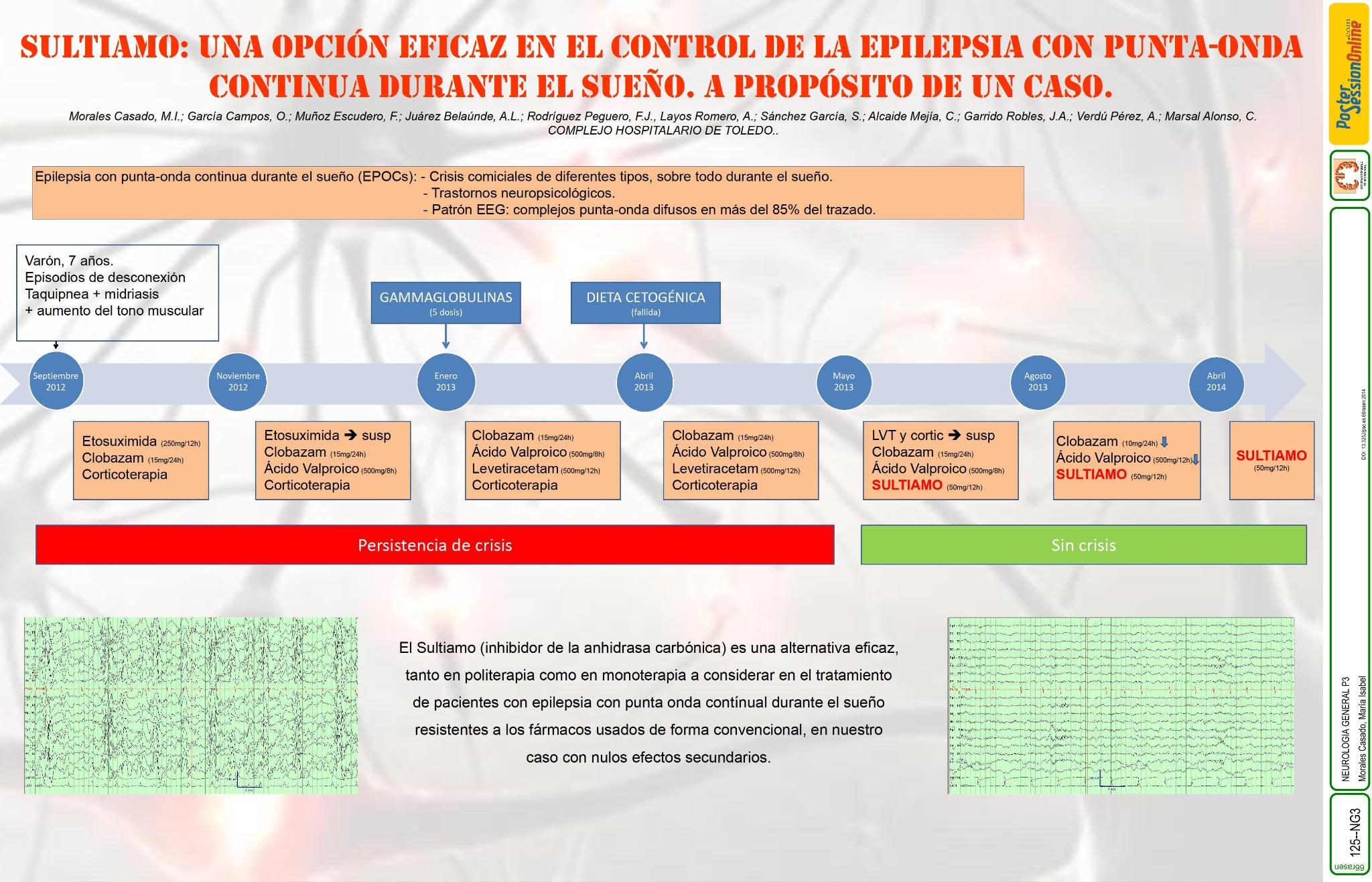 Sultiamo: una opción eficaz en el control de la epilepsia con punta-onda continua durante el sueño. A propósito de un caso