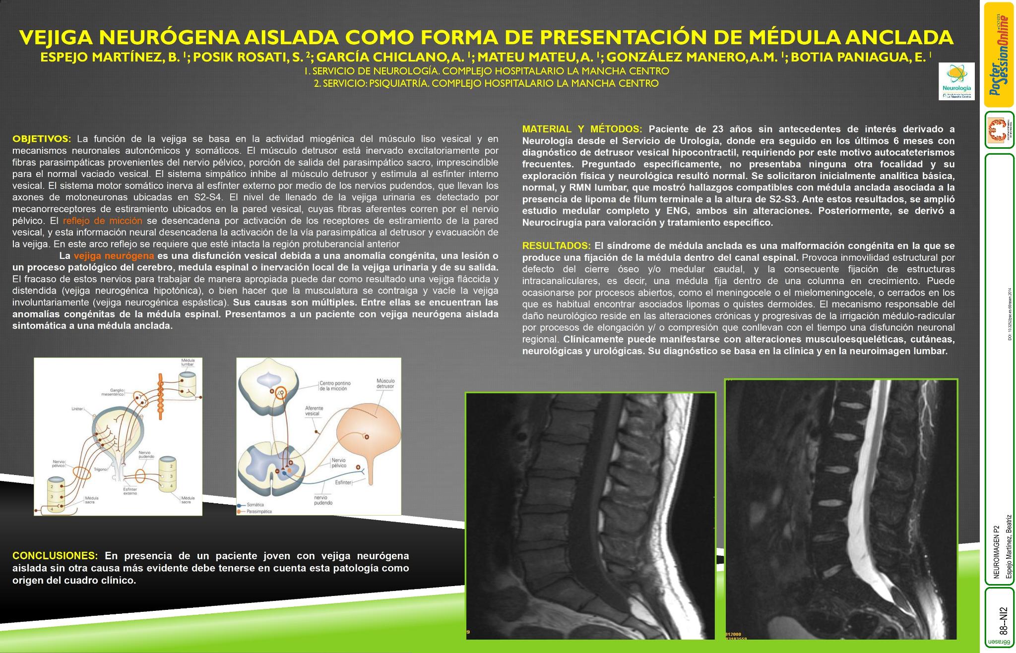 Vejiga neurógena aislada como forma de presentación de médula anclada