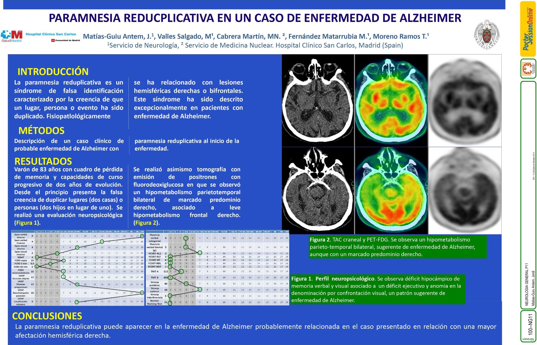 Paramnesia reduplicativa en un caso de enfermedad de Alzheimer