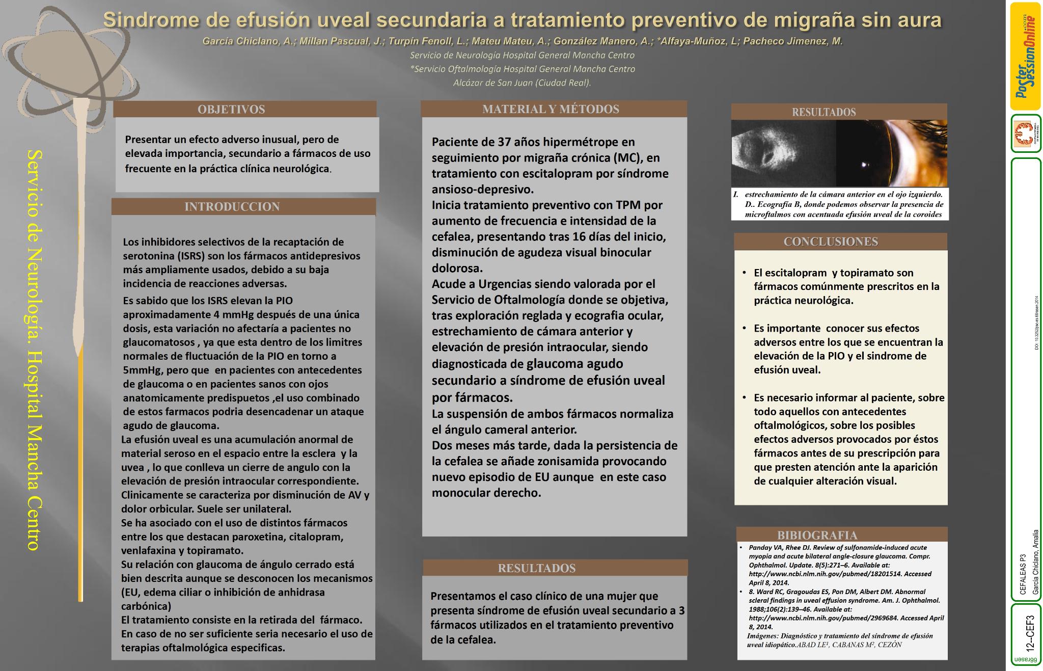 Sindrome de efusión uveal secundaria a tratamiento preventivo de migraña sin aura
