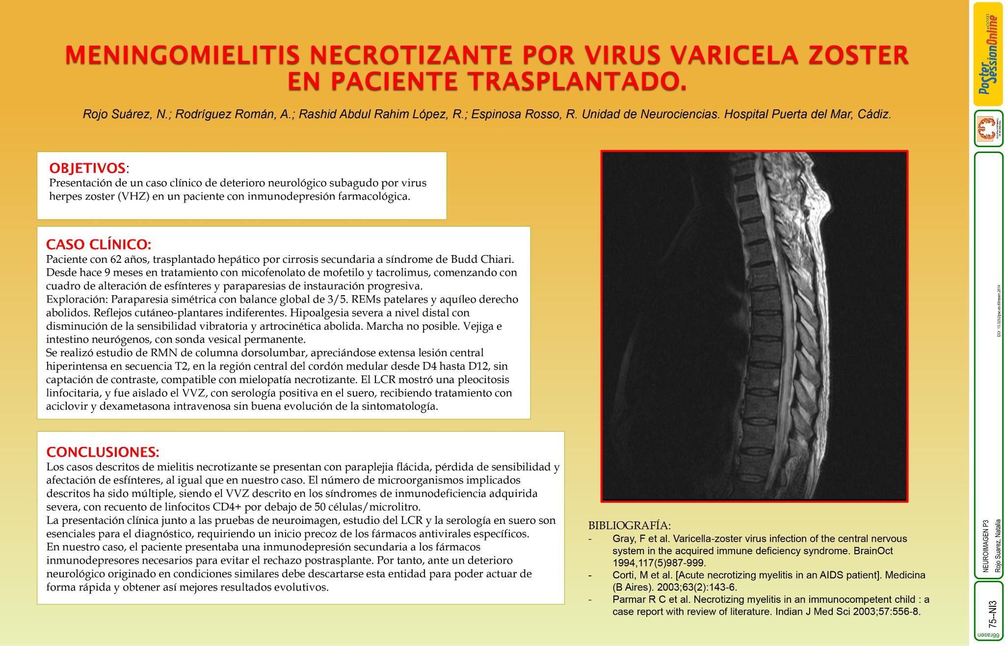 Meningomielitis necrotizante por virus varicela zoster en paciente trasplantado