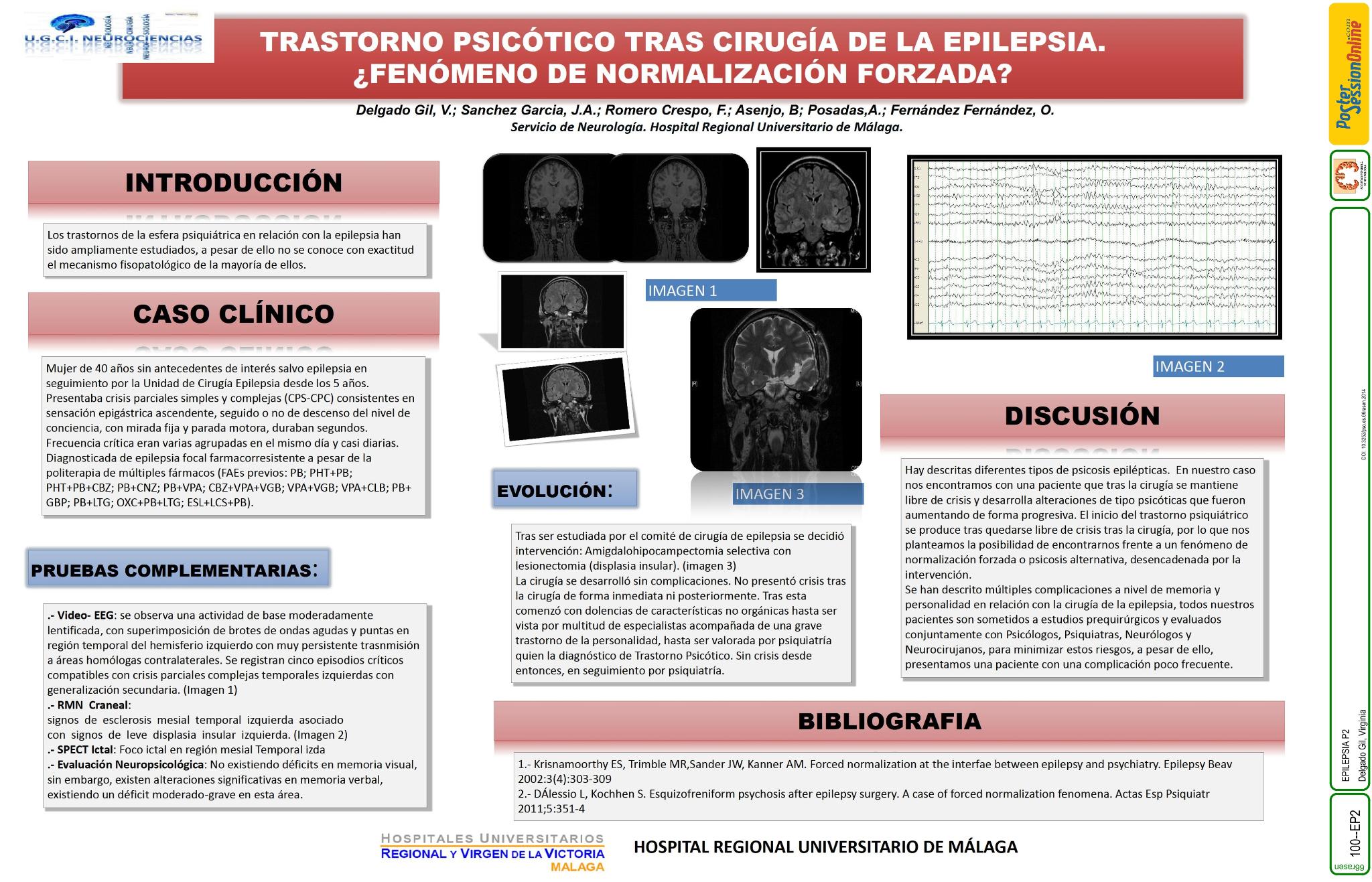 Trastorno psicótico tras cirugía de la epilepsia. ¿Fenómeno de normalización forzada?