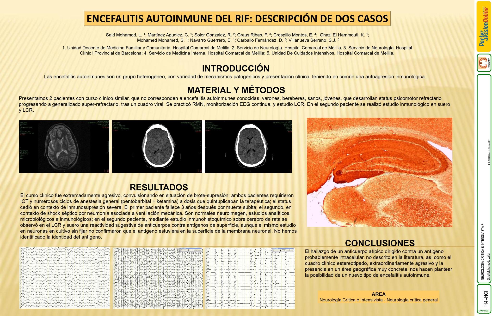 Encefalitis autoinmune en el RIF: descripción de dos casos