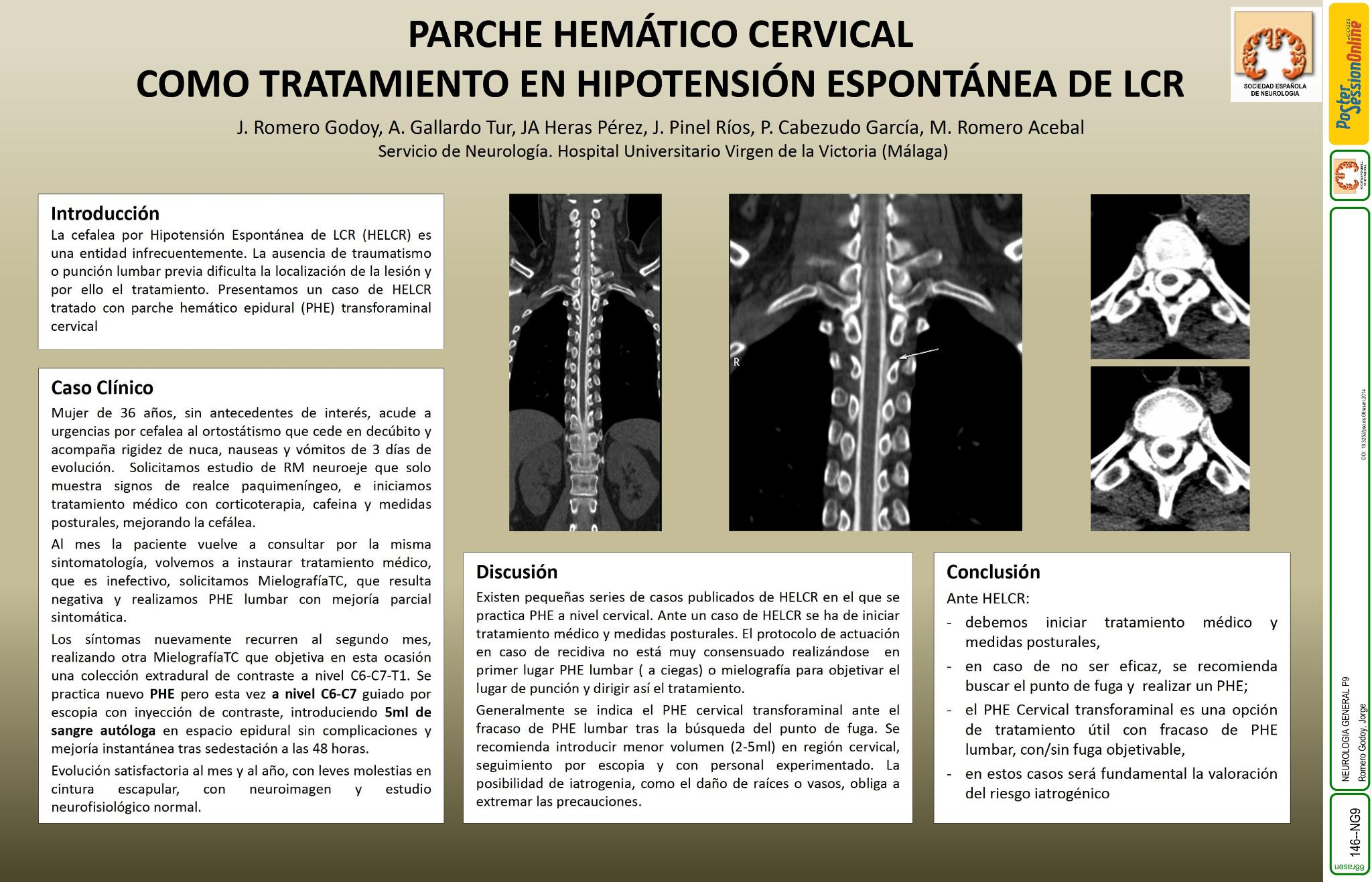 Parche de sangre cervical como tratamiento hipotensión espontánea de LCR
