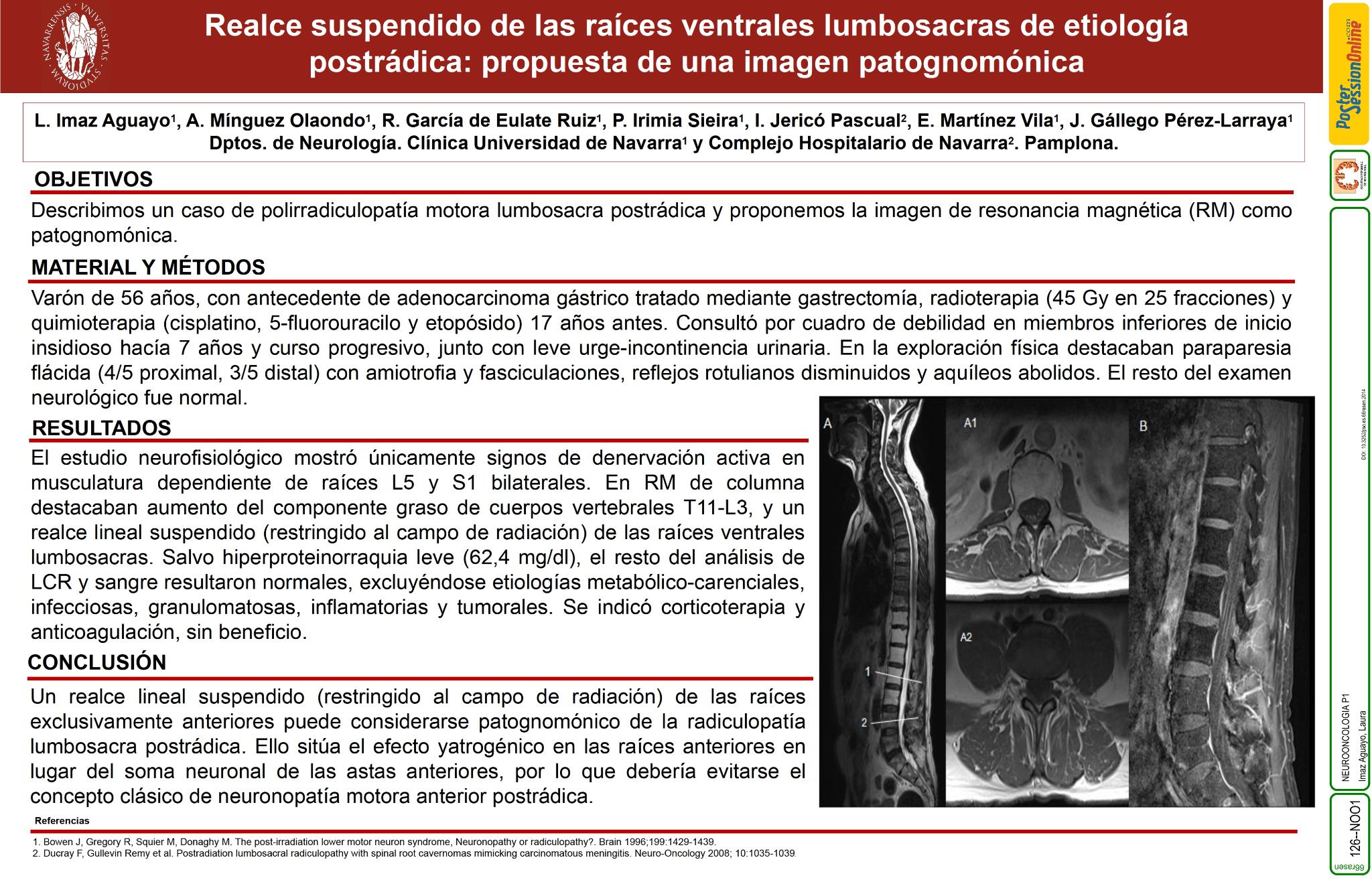 Realce suspendido de las raíces ventrales lumbosacras de etiología postrádica: propuesta de una imagen patognomónica
