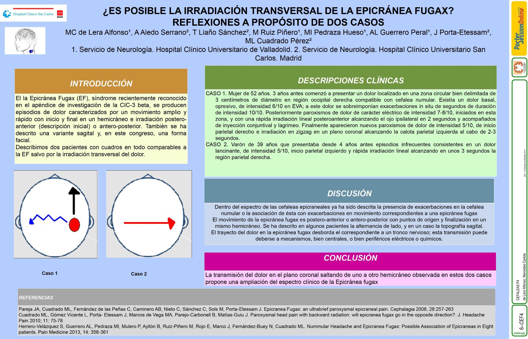 ¿Es posible la irradiación transversal de la Epicránea Fugax? Reflexiones a propósito de dos casos