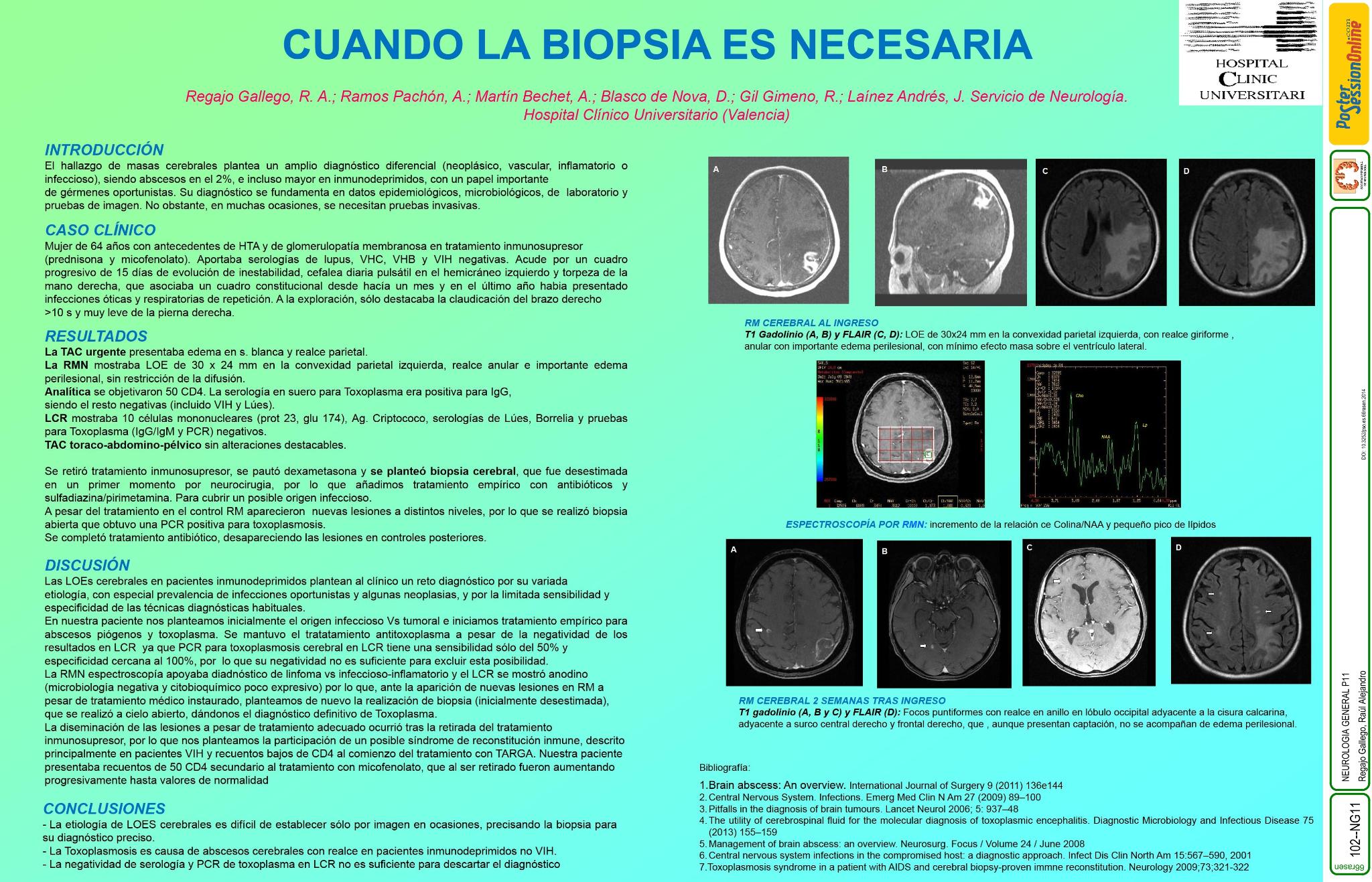 Cuando la biopsia es necesaria