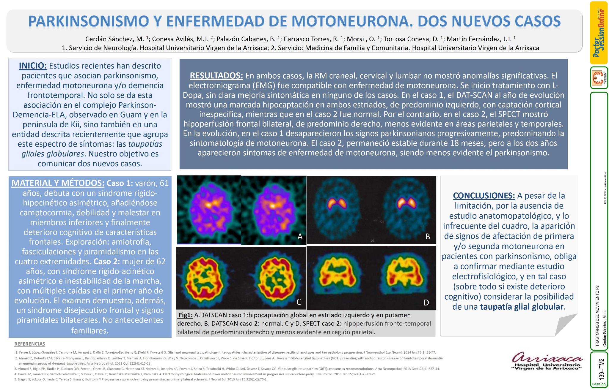 Parkinsonismo y enfermedad de motoneurona: dos nuevos casos