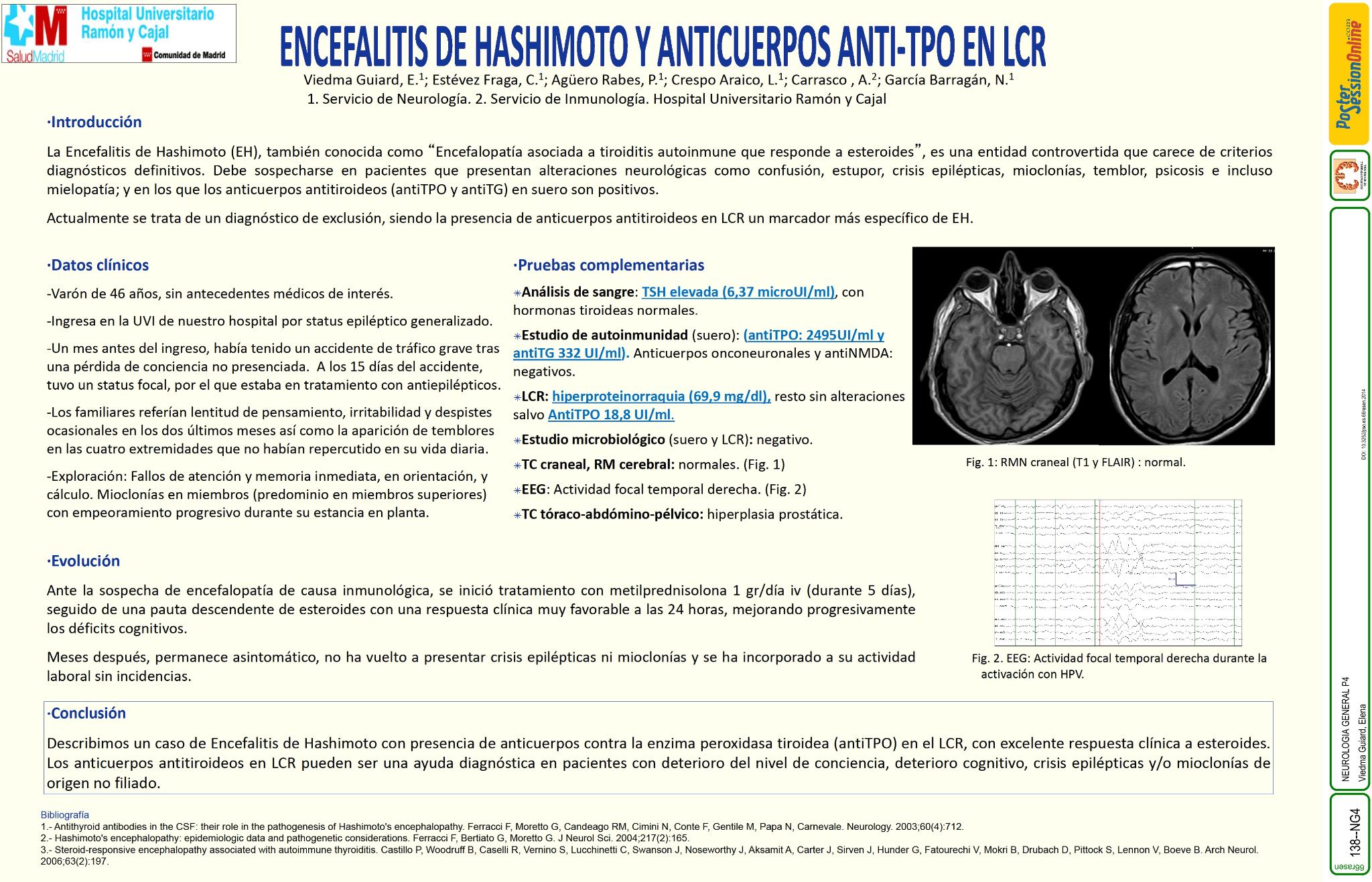 Encefalitis de Hashimoto y anticuerpos anti-TPO en LCR