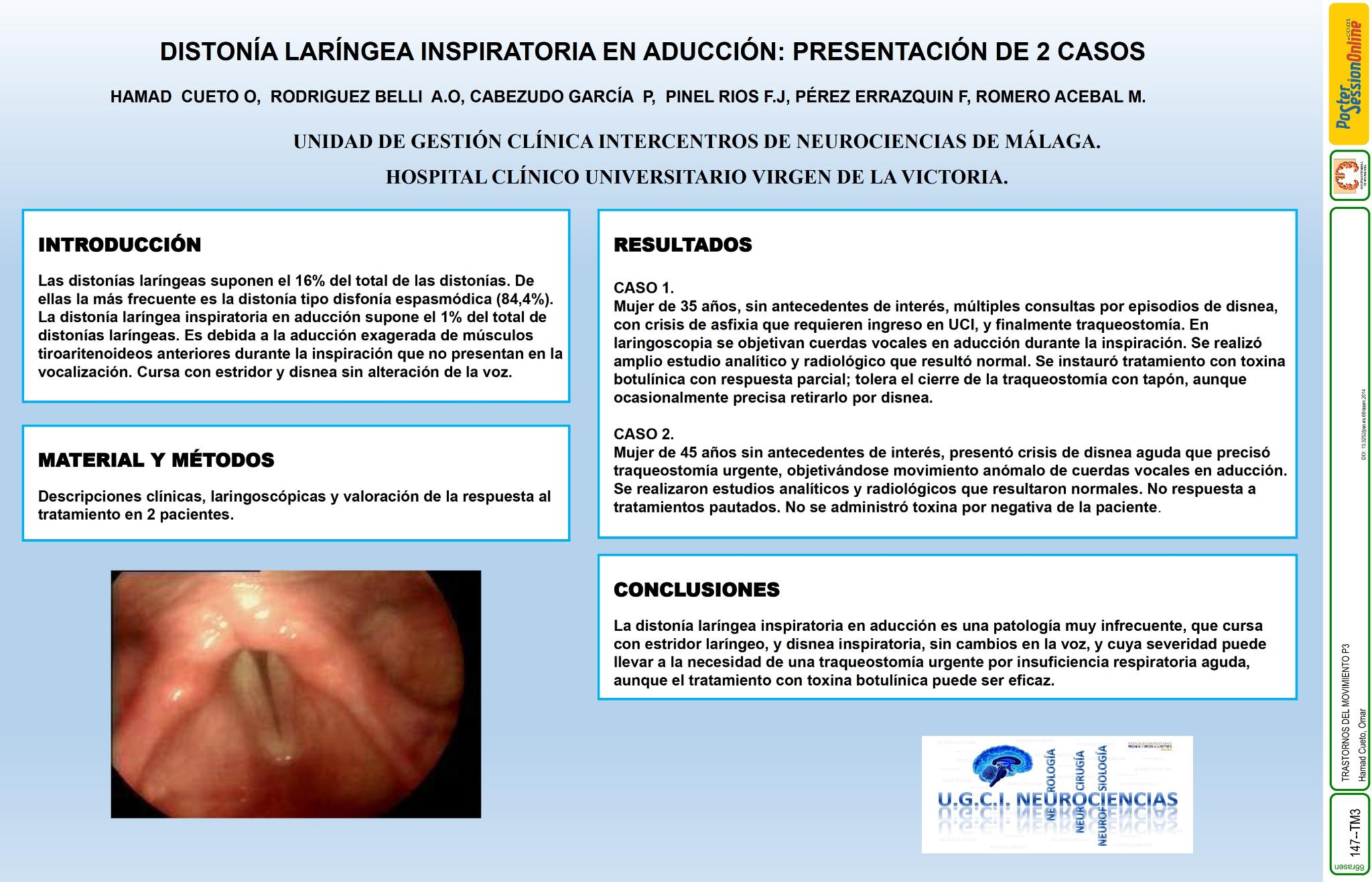 Distonía laríngea inspiratoria en aducción: presentación de 2 casos