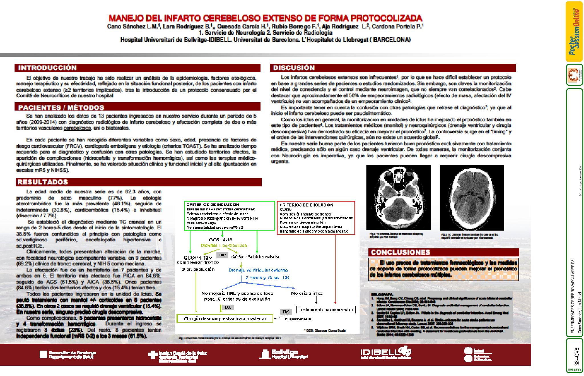 Manejo del infarto cerebeloso extenso de forma protocolizada