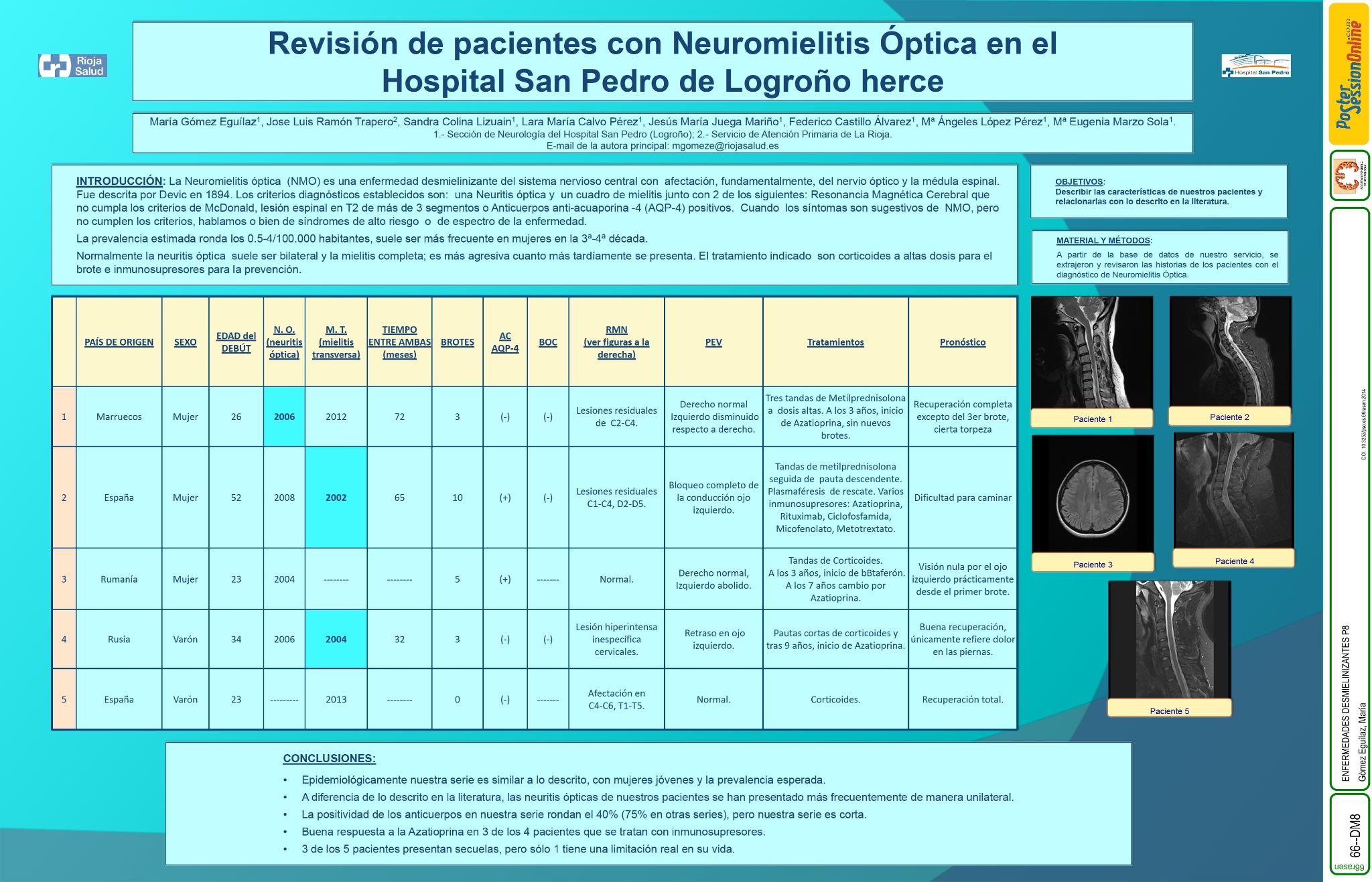 Revisión de pacientes con neuromielitis óptica en Hospital San Pedro de Logroño