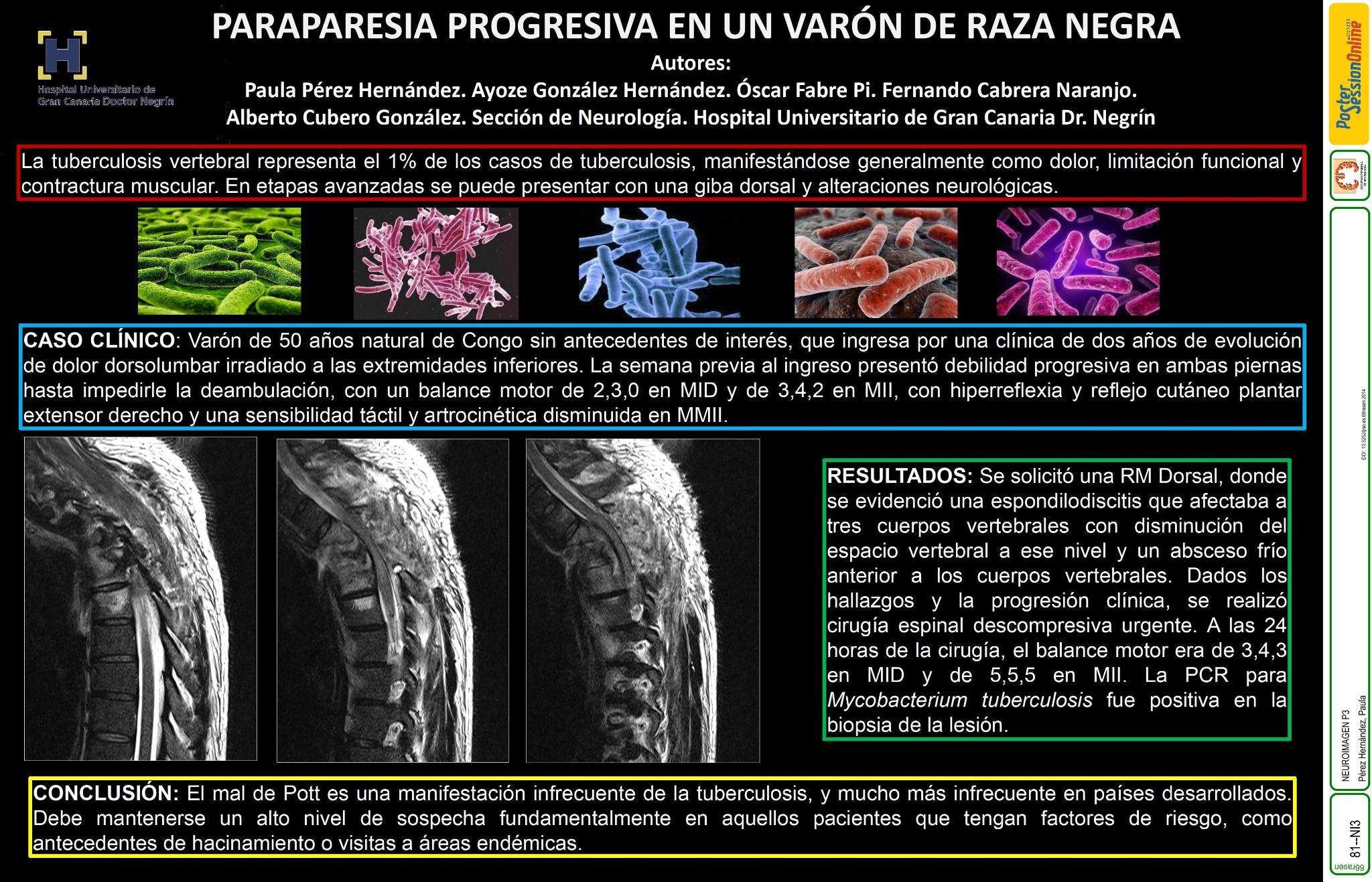 Paraparesia progresiva en un varón de raza negra