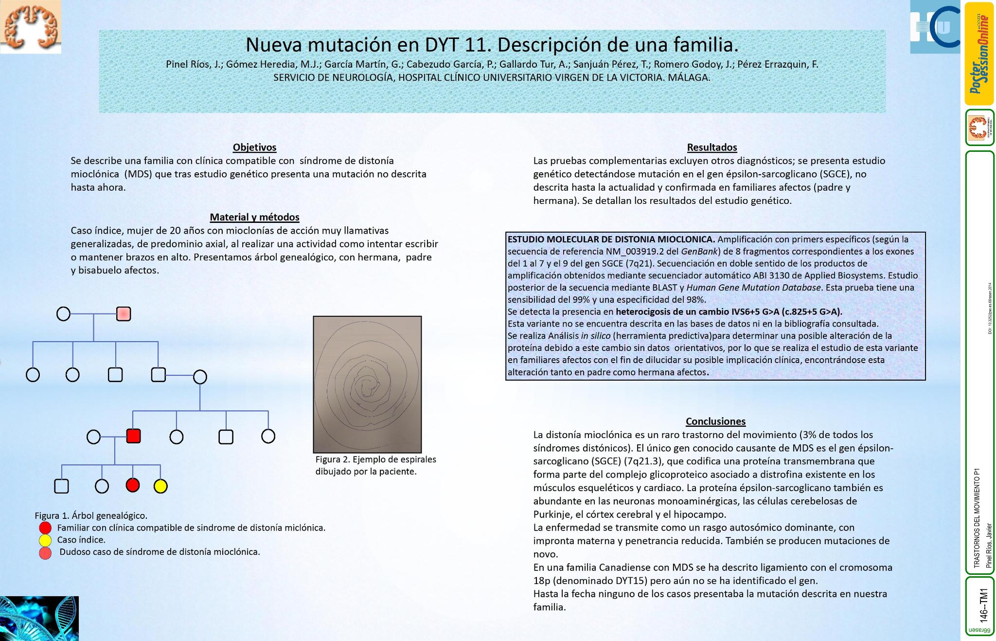 Nueva mutación en DYT 11. Descripción de una familia