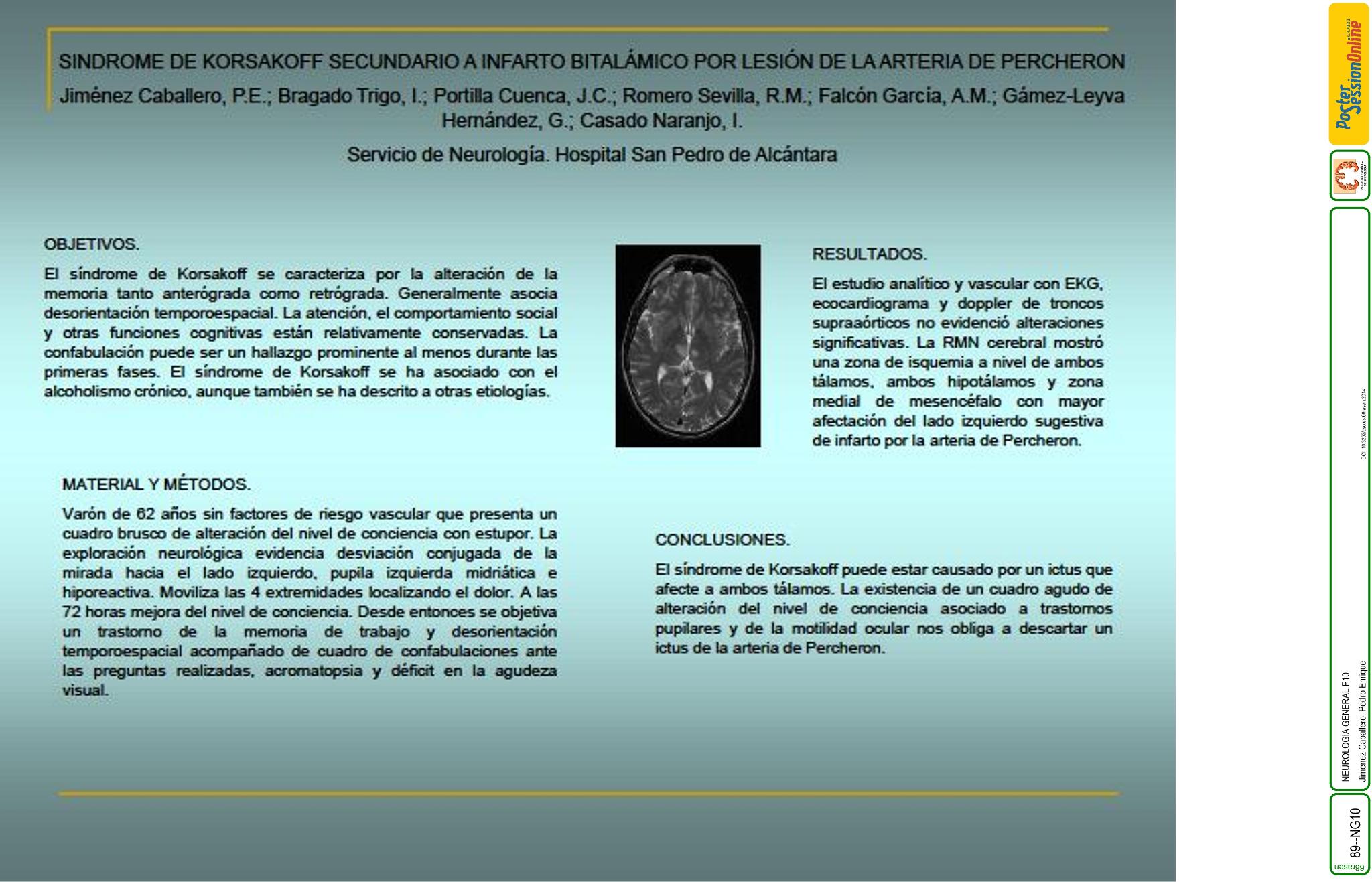 Sindrome de Korsakoff secundario a infarto bitalámico por lesión de la arteria de percheron