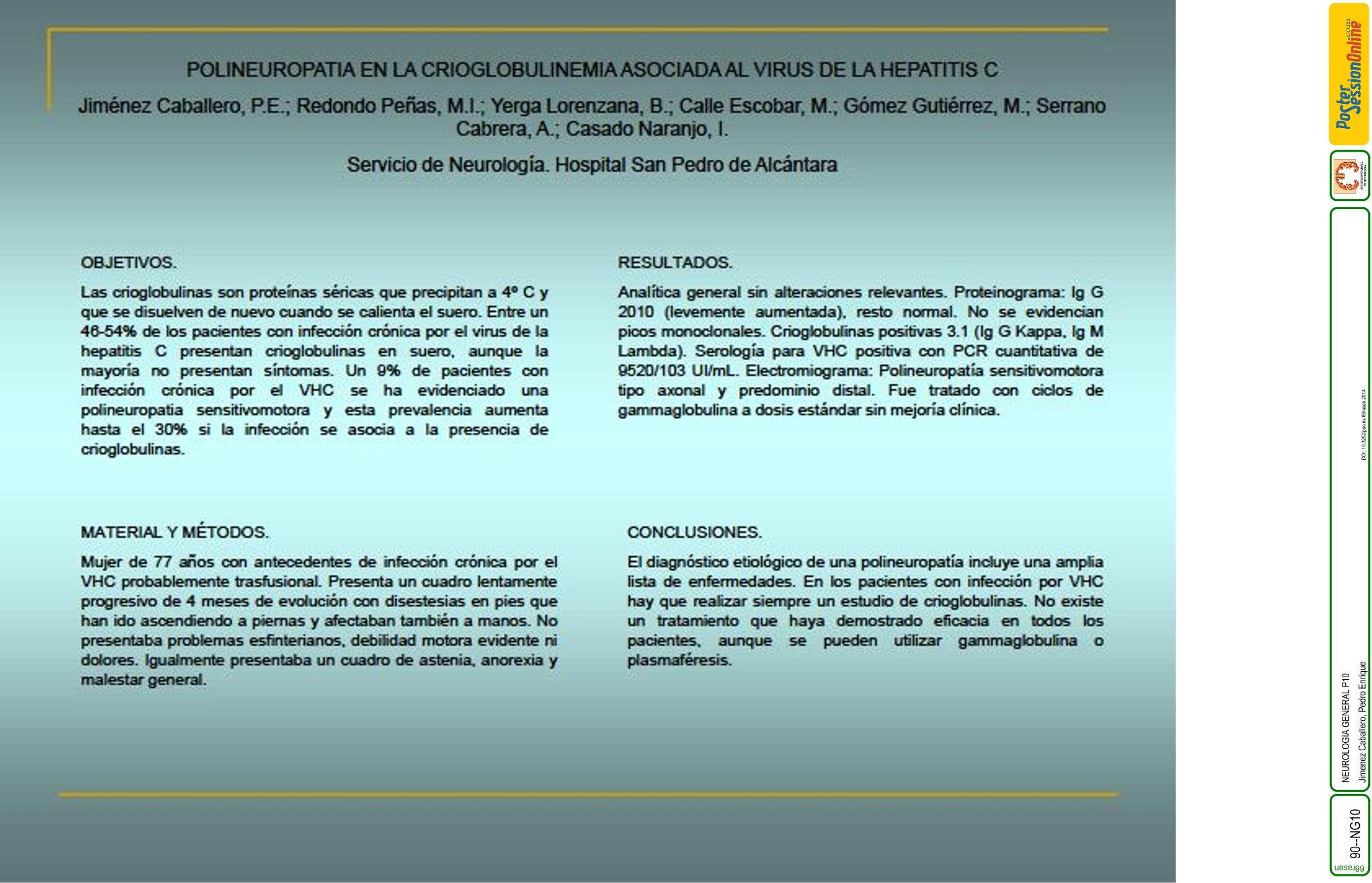 Polineuropatia en la crioglobulinemia asociada al virus de la hepatitis C