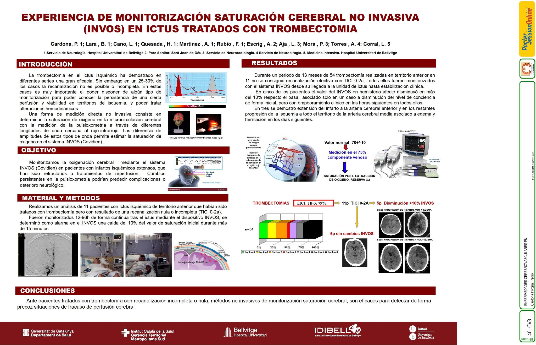 Experiencia de monitorización saturación cerebral no invasiva (INVOS) en ictus tratados con trombectomia