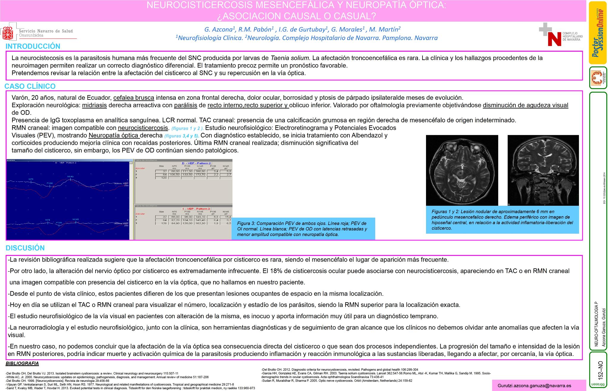 Neurocistercosis mesencefálica y neuropatía óptica: ¿asociación causal o casual?