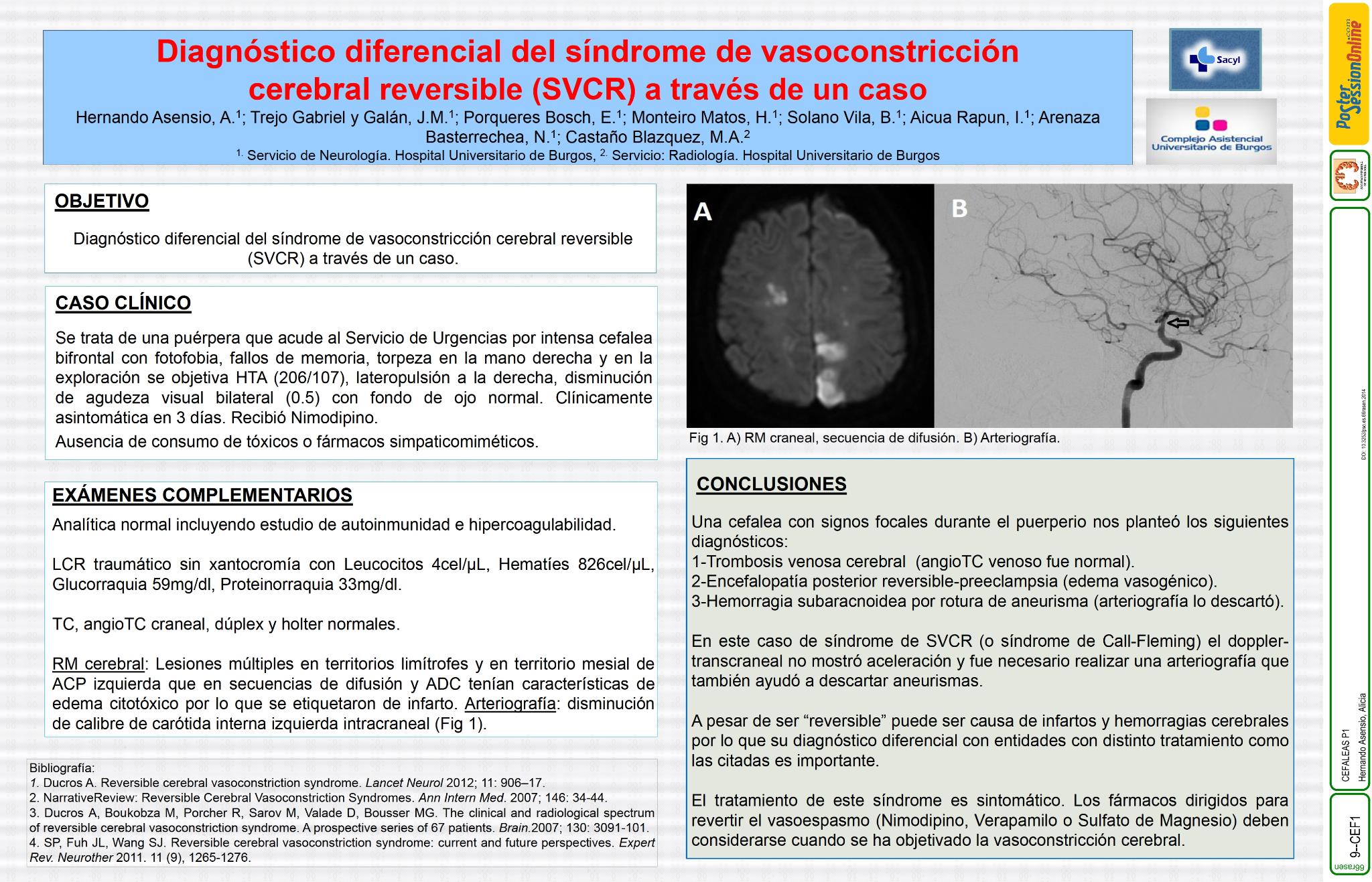Diagnóstico diferencial del síndrome de vasoconstricción cerebral reversible en el puerperio