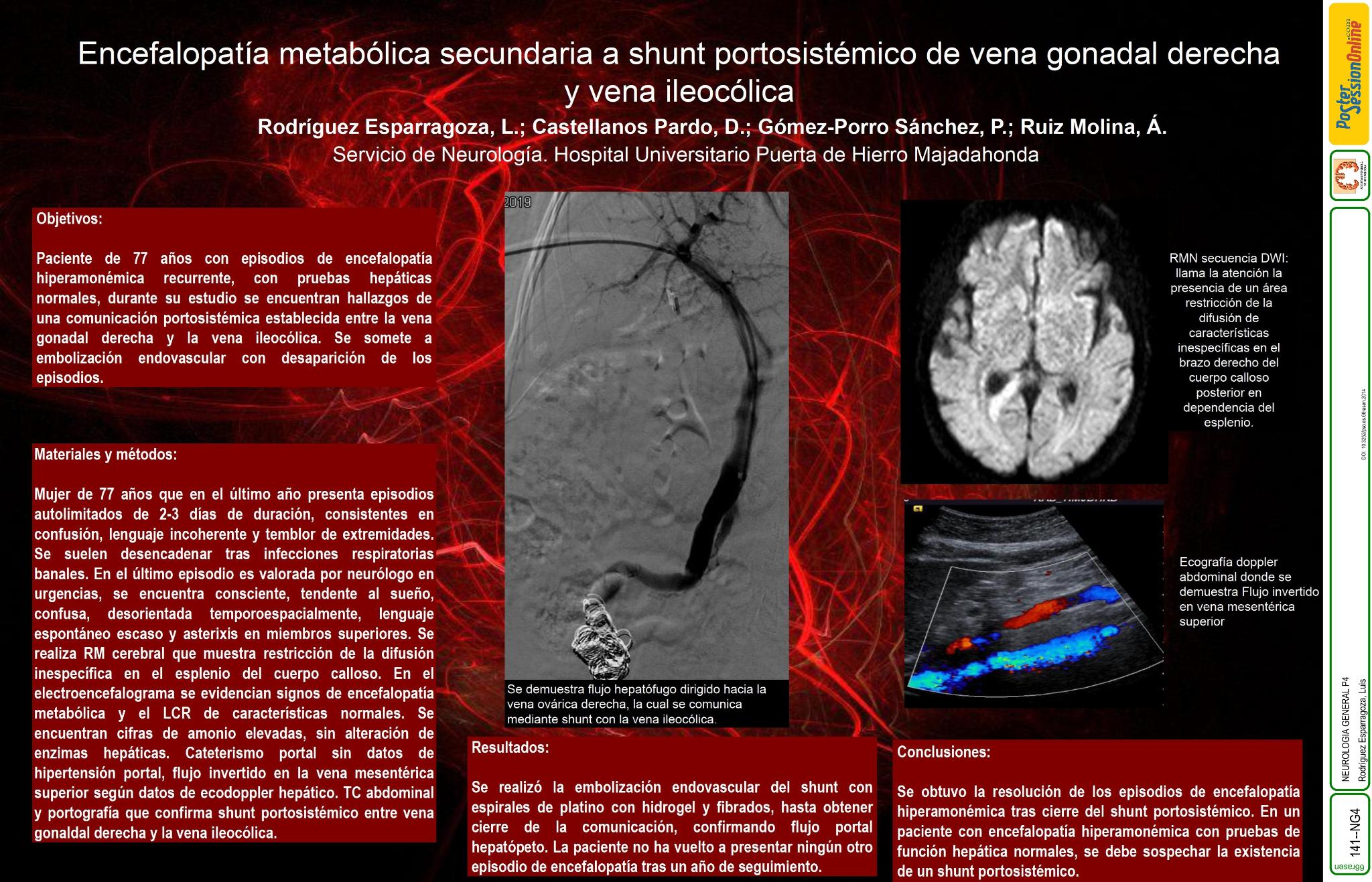 Encefalopatía metabólica secundaria a shunt portosistémico de vena gonadal izquierda y arteria ileocólica