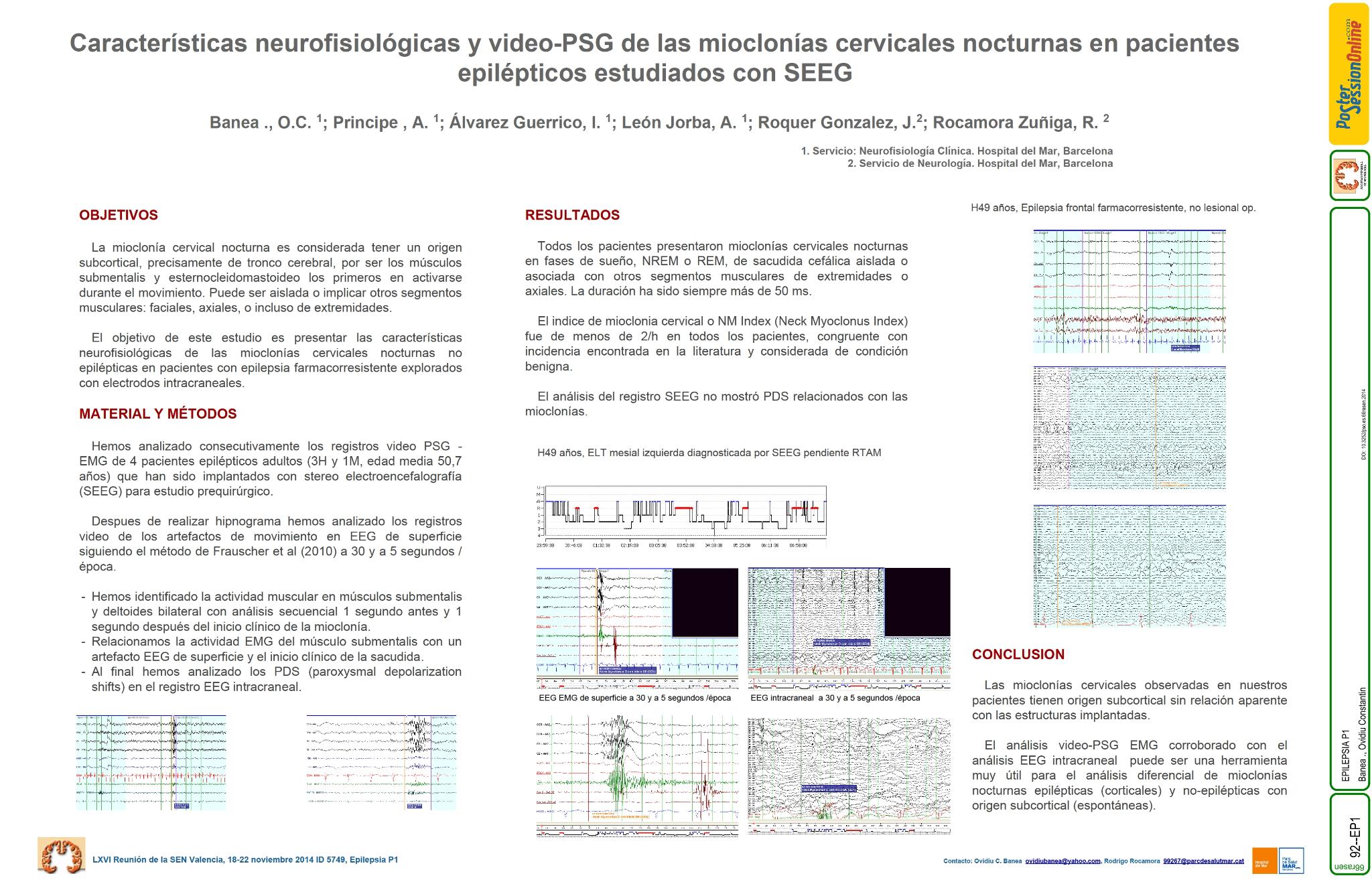 Características neurofisiológicas y video-PSG de las mioclonías cervicales nocturnas en pacientes epilépticos estudiados con SEEG