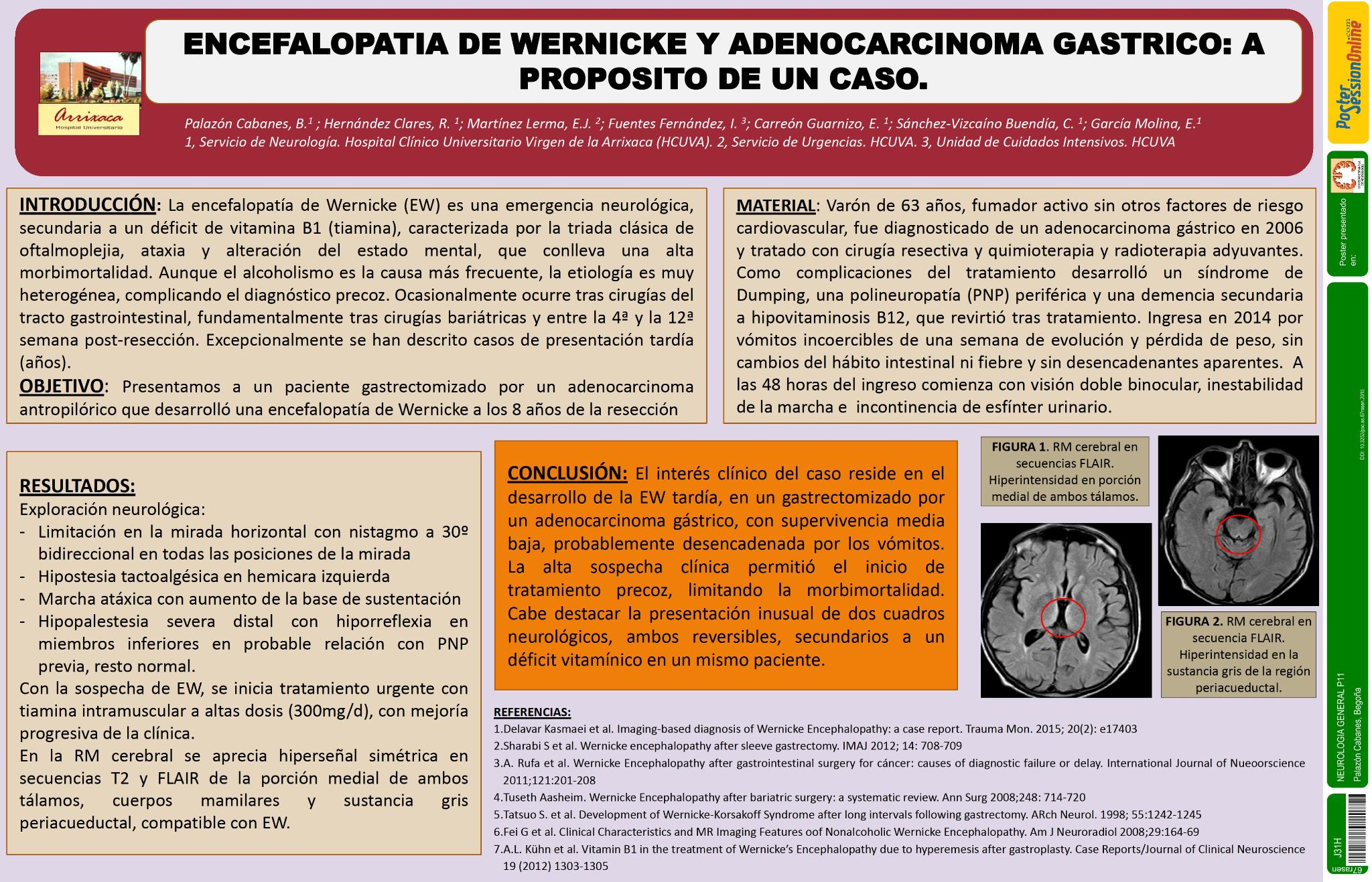 Encefalopatia de Wernicke de presentación tardía tras adenocarcinoma gastrico: a propósito de un caso