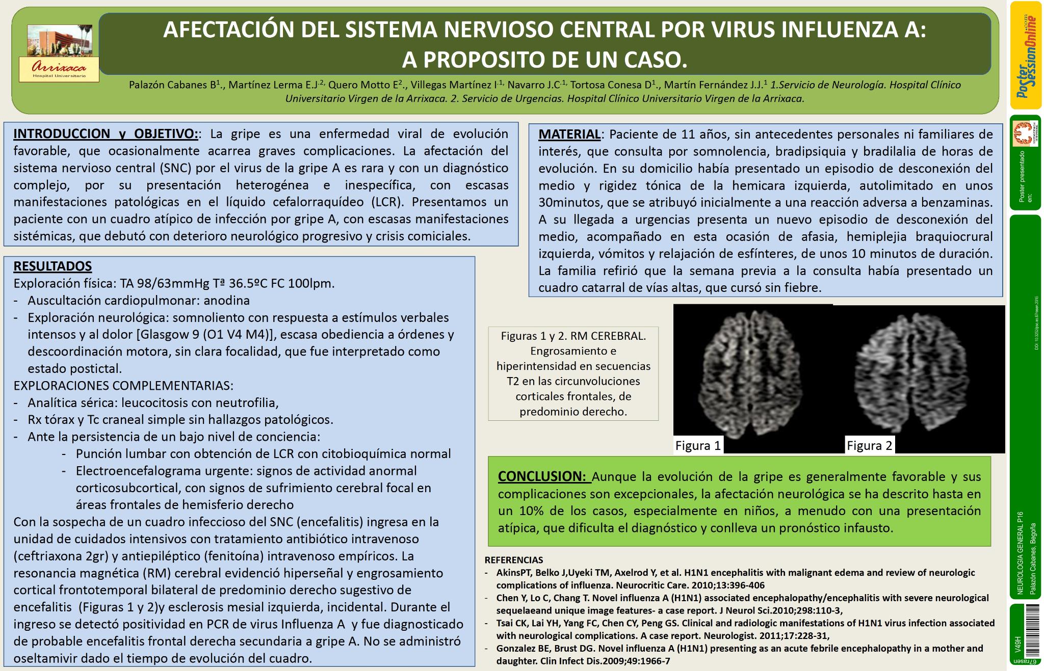 Afectación del sistema nervioso central por virus influenza A: a proposito de un caso