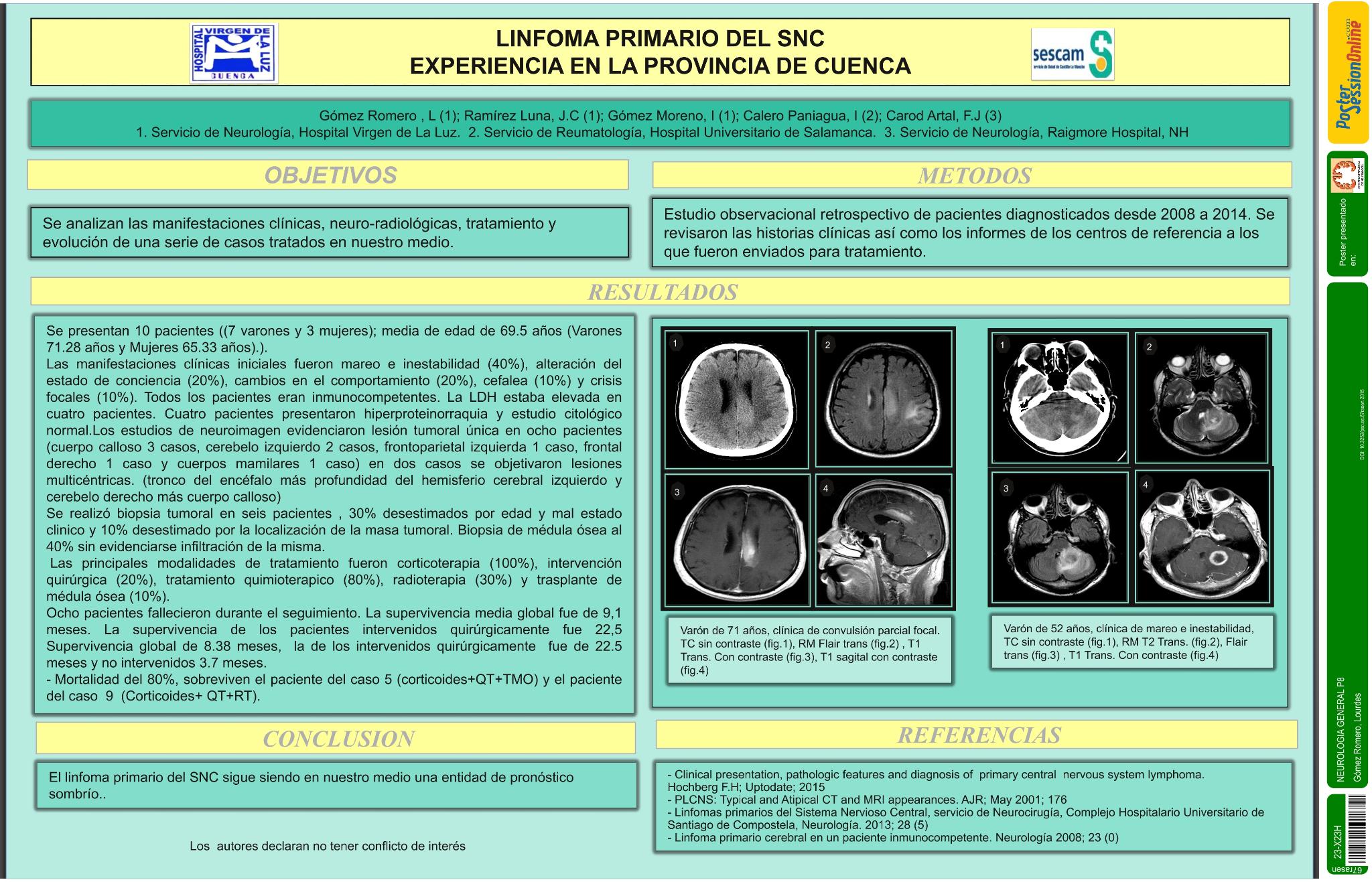 Linfoma Primario del SNC: experiencia en la provincia de Cuenca