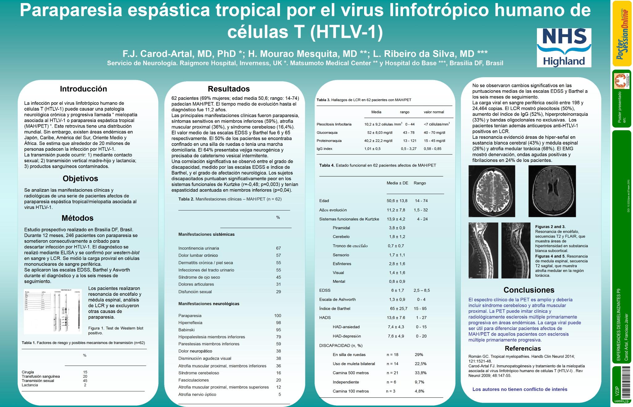 Paraparesia espástica tropical por el virus linfotrópico humano de células T
